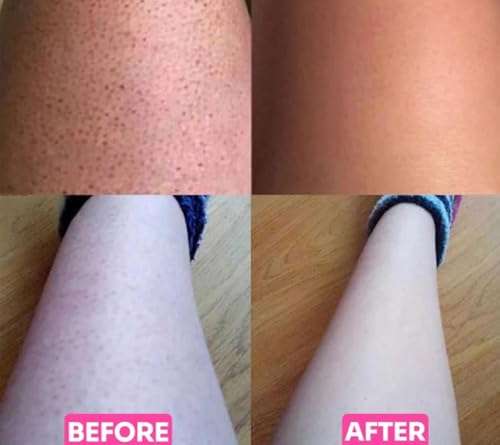 Safety Edge Reusable Shaving Razor with Support Stand and 10 Platinum Coated Double Edge Exfoliating Glove Safety Razor Blades - Razors for Women and Men Suitable for Gifts (Pink) 4