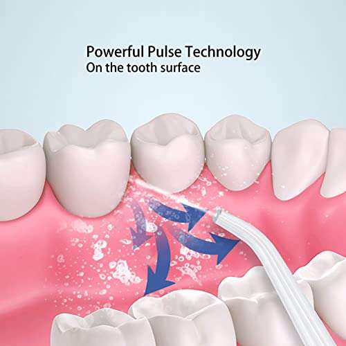 Portable Electric Dental Oral Irrigator, water flosser for teeth, Food Residues Removal White Teeth Cleaning Device 6
