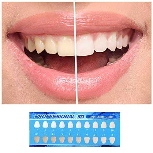 Teeth Whitening Gel Kit, MS.DEAR Dental Equipment 44% Peroxide Dental Bleaching System LED Light Oral Gel Kit Tooth Whitener 6