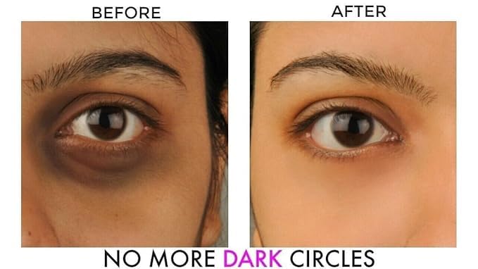Riva Trends Avarta Under Eye Cream – Lightening & Refreshing Eye Care for Dark Circles | 10 g 3