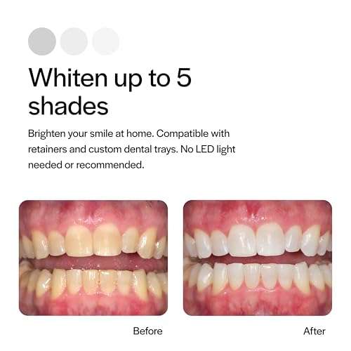 Opalescence 35% CP Mint - Gel Syringes Teeth Whitening - Refill Kit (4 Syringes Total) Carbamide Peroxide Gel. Made by Ultradent. Tooth Whitening Refill Syringes 5197-2 4