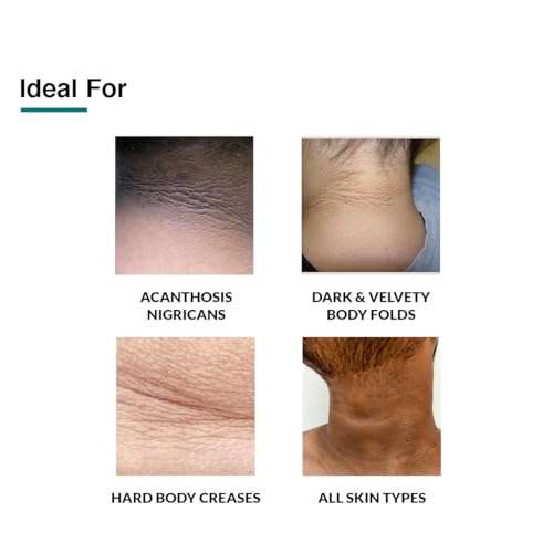 Fixderma Nigrifix cream for Acanthosis Nigricans | For Dark Body Parts Like Neck, Knuckles, Armpits, Ankles, Thighs, Elbows | Exfoliant- 100g 4