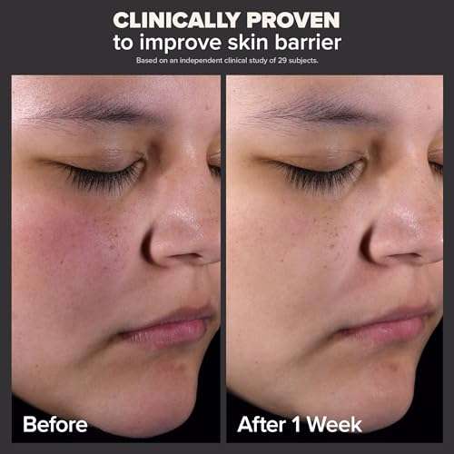 PAULA'S CHOICE PERFECTING 2% BHA Liquid Salicylic Acid Exfoliant-Facial Exfoliant for Blackheads, Enlarged Pores, Wrinkles, Fine Lines- 118 ml Bottle (Model Number: 22010) 2