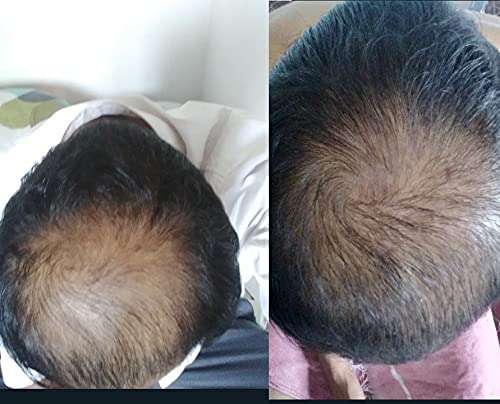 Lahiya Hair And Beard Growth Oil 5