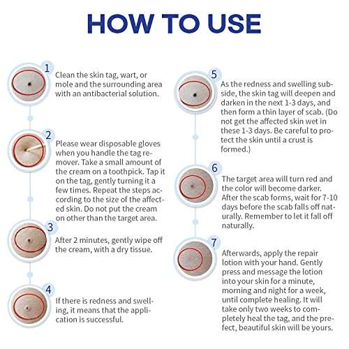 Skin Tag Removal Treatment-Skin Tag Remover-Made of Natural Plant Extracts-Simple and Easy to Apply Skin Tag Remover & Mole Corrector and Repair Lotion Set 5