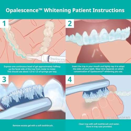 Opalescence 35% CP Mint - Gel Syringes Teeth Whitening - Refill Kit (4 Syringes Total) Carbamide Peroxide Gel. Made by Ultradent. Tooth Whitening Refill Syringes 5197-2 5