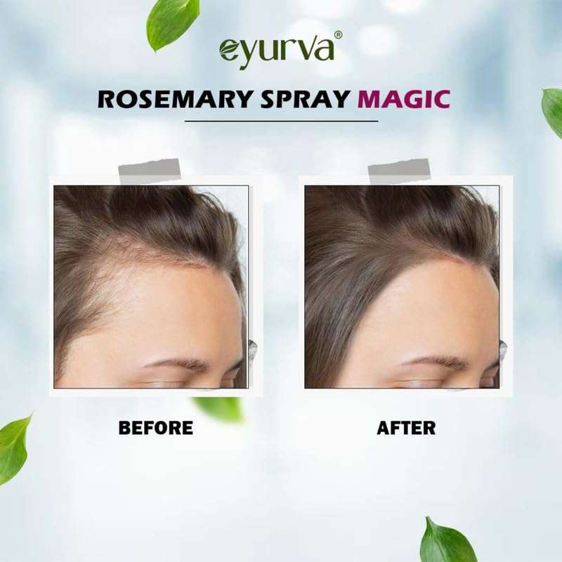 eyurva Rosemary Water Hair Spray | For Frizzy Hair | Adds Shine | Helps Hair | Strengthens Hair | Suitable For All Hair Types | Men & Women 100 ml 4