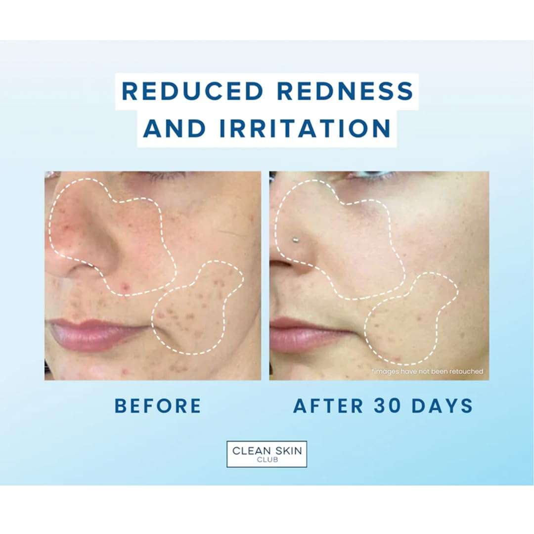 Cheekee Disposable Face Towels - Dermatologist Tested, Biobased, Clinically Proven, 100% Vegan & Cruelty-Free, Ultra Soft for Sensitive Skin, Reduces Redness, Ideal for Skincare and Travel (50 units) 5