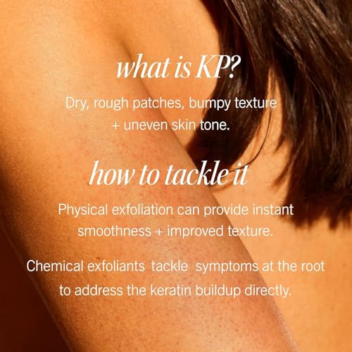First Aid Beauty - KP Bump Eraser Body Scrub with 10% AHA, Keratosis Pilaris Skin Exfoliator with Glycolic and Lactic acids, Helps Reduce Chicken Bumps, Safe for Sensitive Skin, 2 oz 4