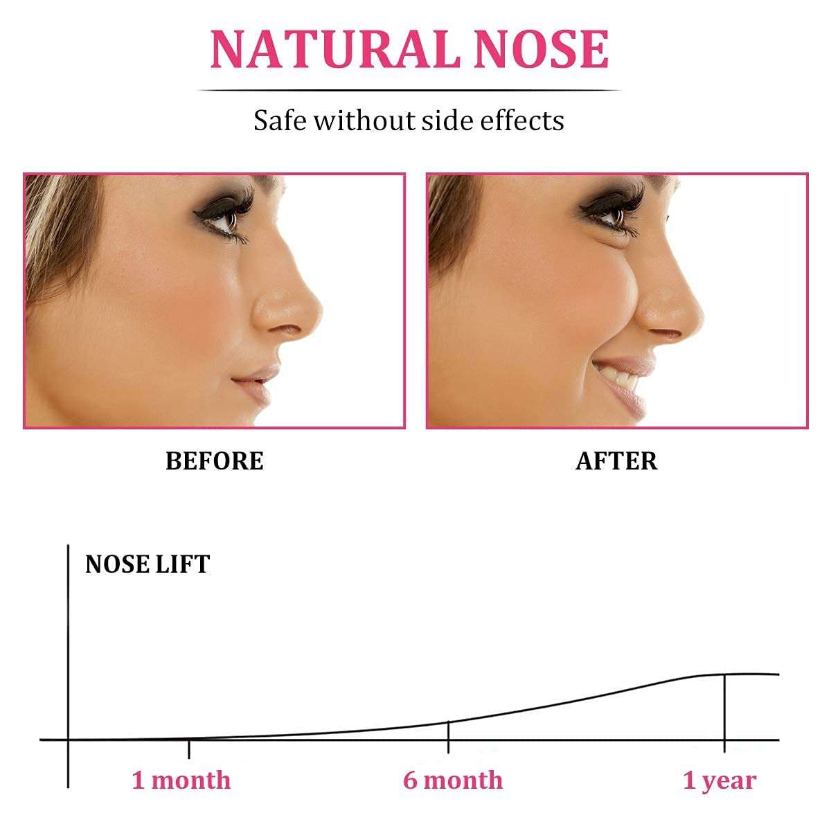Nose Shaper, Invisible Nose Up Lifting Clip Shaper Shaping Tool Straightening Beauty Kit Clip Corrector 5