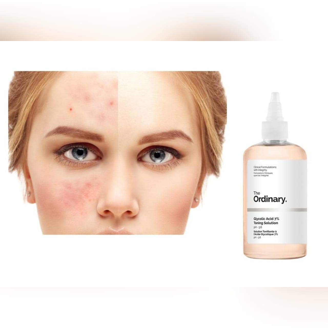 The Ordinary Glycolic Acid 7% Toning Solution, Pack of 240ml liquid 6