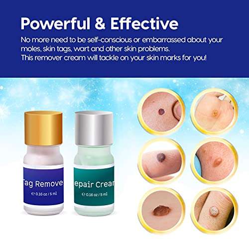 Skin Tag Removal Treatment-Skin Tag Remover-Made of Natural Plant Extracts-Simple and Easy to Apply Skin Tag Remover & Mole Corrector and Repair Lotion Set 4