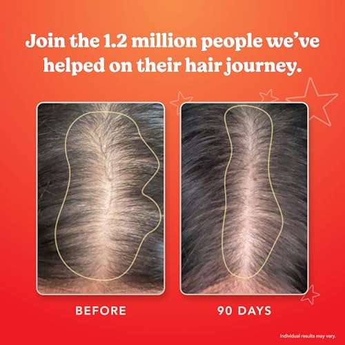 HAIRtamin MOM Vegan Prenatal & Postnatal Multivitamin Supplement & Hair Vitamin Pregnancy, Postpartum, Breastfeeding Probiotic One-a-Day Hair Vitamins with Biotin, Zinc, Iron (30 Counts) 6