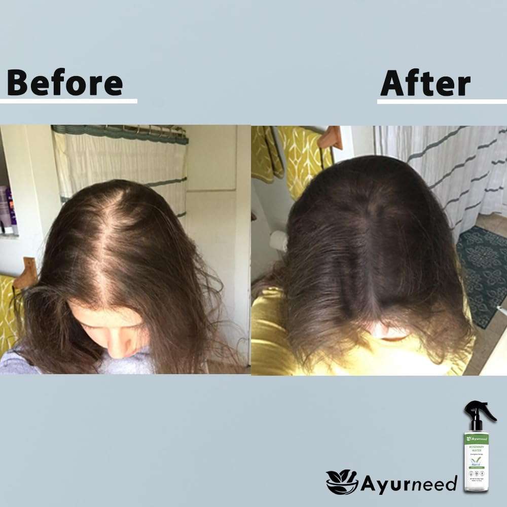 Rosemary Water Hair Spray for Hair Growth and Scalp Health – 100% Natural Herbal Mist to Reduce Hair Fall, Strengthen Roots, and Control Dandruff 6