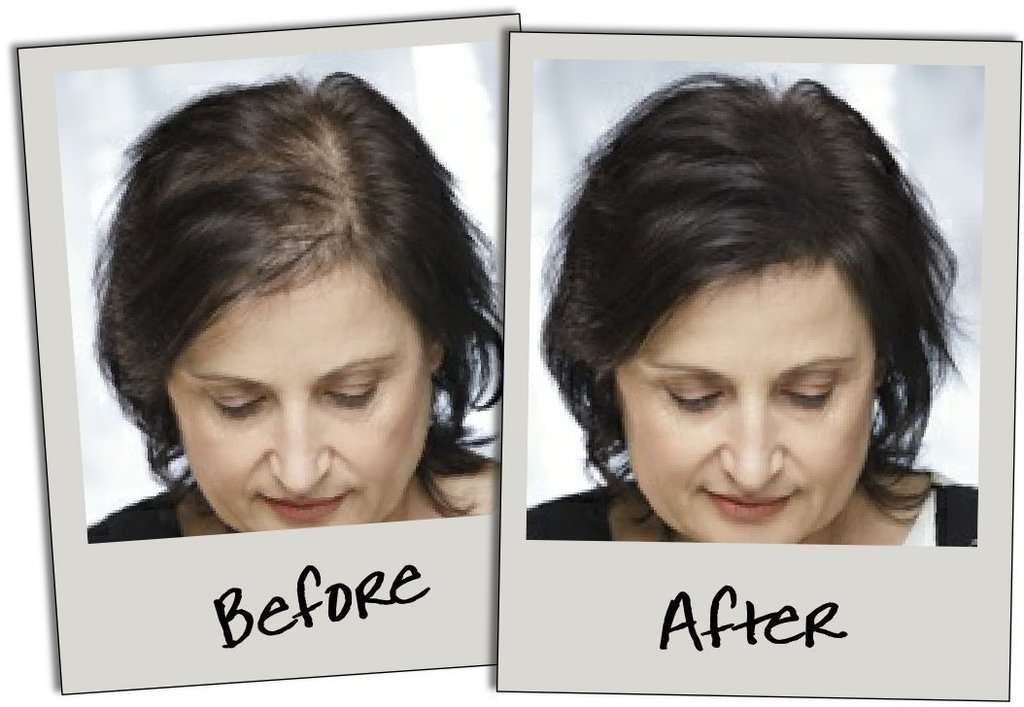 Ekan Hair Fibers For Thinning Hair For Men And Women 36 Gram (Dark Brown) 6