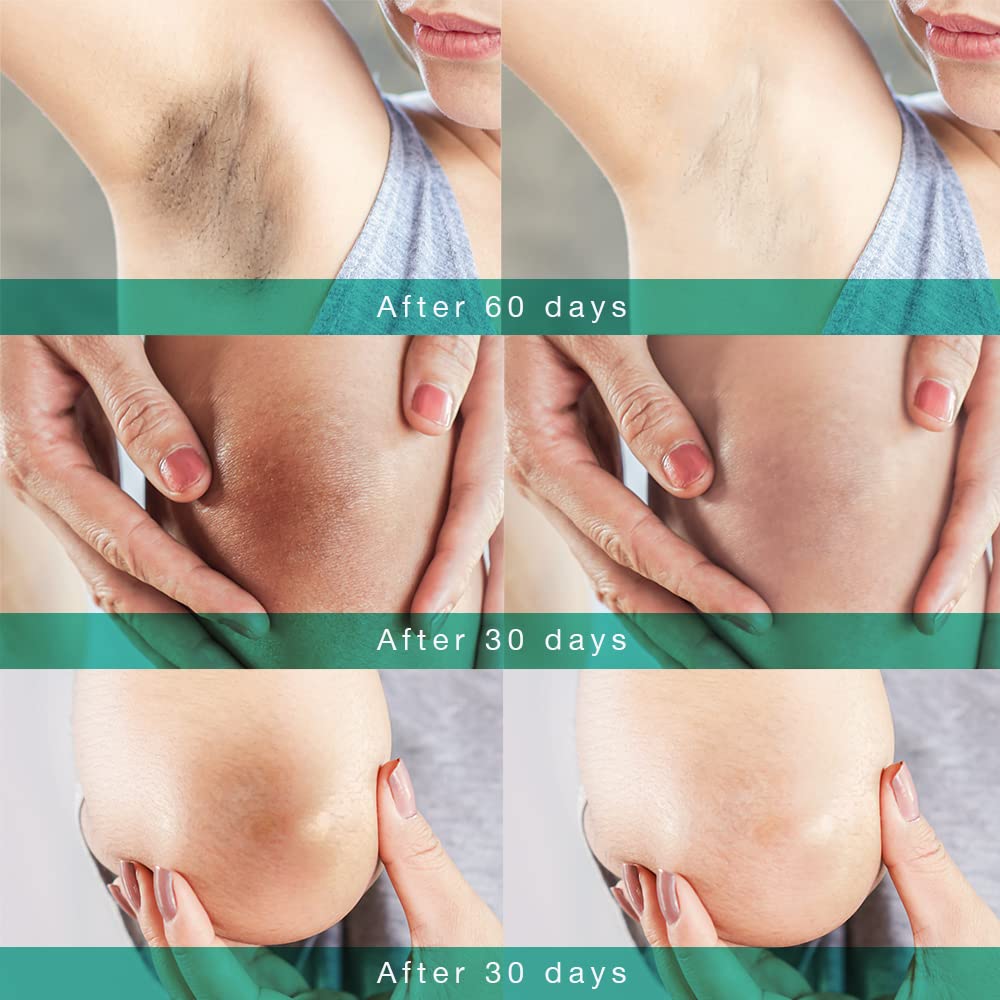 Le’phoqua Underarm Cream, Dark Spot Corrector Cream, Instant Results For Intimate Area, Body, Underarms, Armpit, Knees, Elbows, and inner Thigh 3