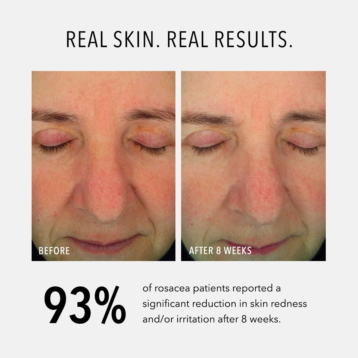 Hydropeptide Soothing Serum, Moisturizing & Anti-Aging Peptide Facial Serum, 1 Ounce 4