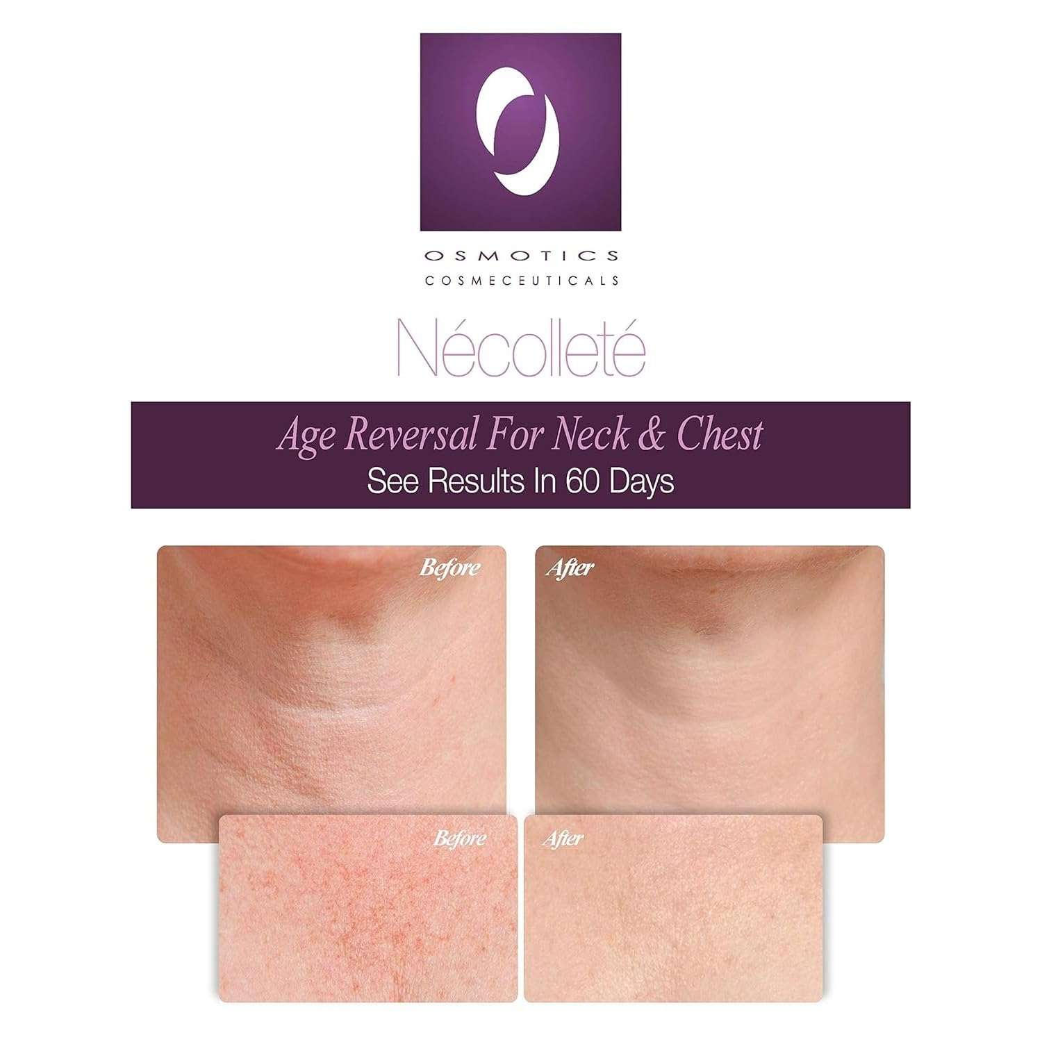 Osmotics Nécolleté Age Reversal for Neck and Chest - Firms, Smooths & Tightens Fragile Skin on Neck, Chest & Décolleté | Anti-Aging Formula for Sun Damage - 1.7oz 3