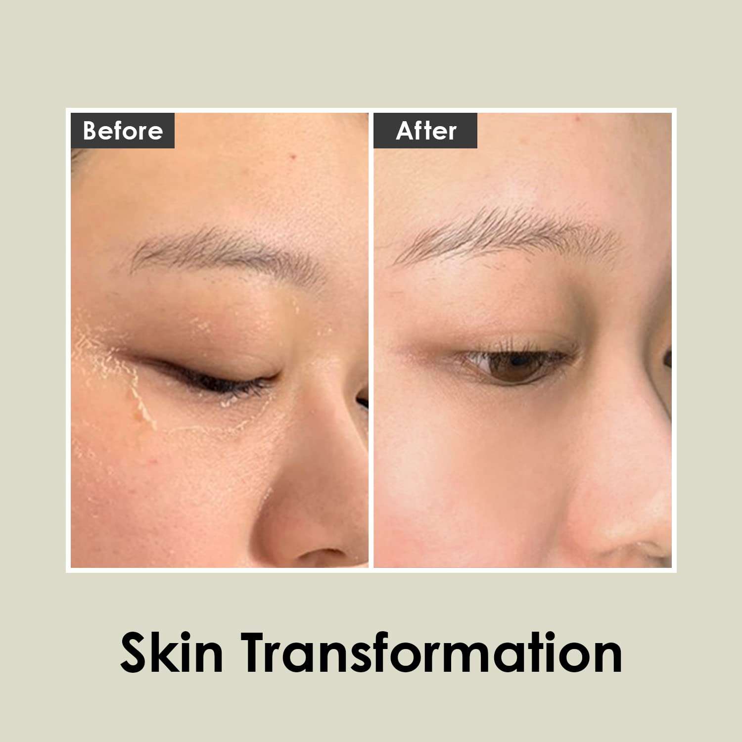 MEDI-PEEL Herbal Peel Tox 4.23 fl oz / 120g | Peeling Facial Soothing Cleanser, Exfoliating Cleanser | Wash Off Cream Mask | Vegan, Korean Skincare, For All Skin Types 6