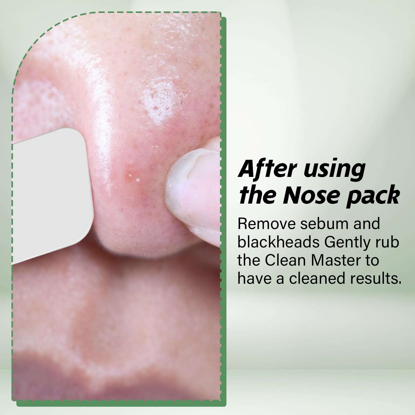 Wanmu Blackhead Remover Tool, Silicone Face Scraper for Deep Cleansing, Professional Blackhead Remover, Skin Scrubber Face Spatula, Skin Care Tool for Men Women (Green) 5