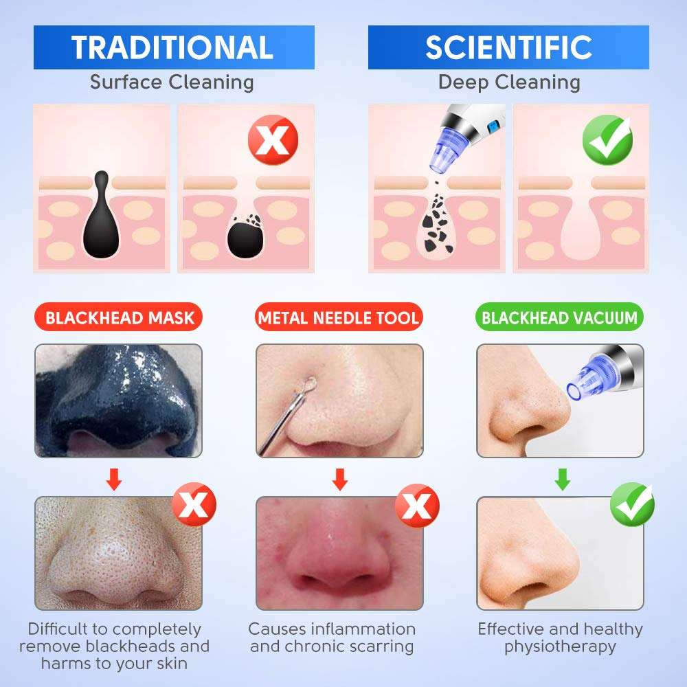 Blackhead Remover Vacuum, Pore Cleaner Electric Facial Blackhead Vacuum Blackhead Removal Tool with 4 Removable Probes 5 Adjustable Suction Force for All Skin Treatment LED Display USB Rechargeable 2