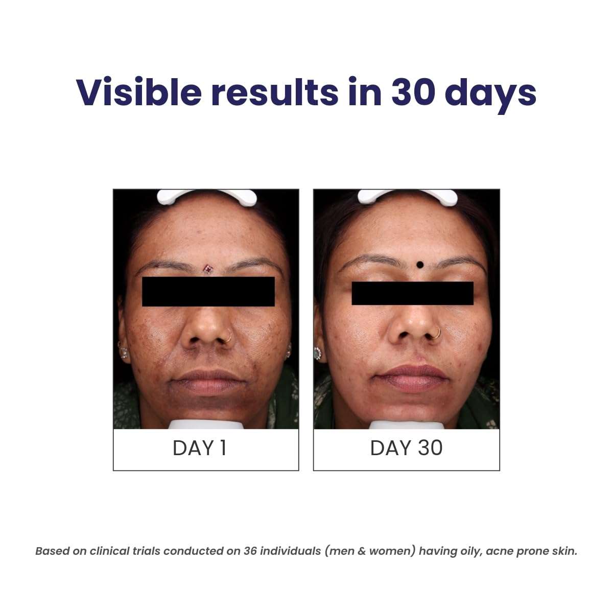 RE' EQUIL Oil Control Face Wash | Soap & Sulphate Free Face Wash with Zinc PCA | Controls Excessive Oil Production | For Oily Acne Prone Skin | 150 ml 6