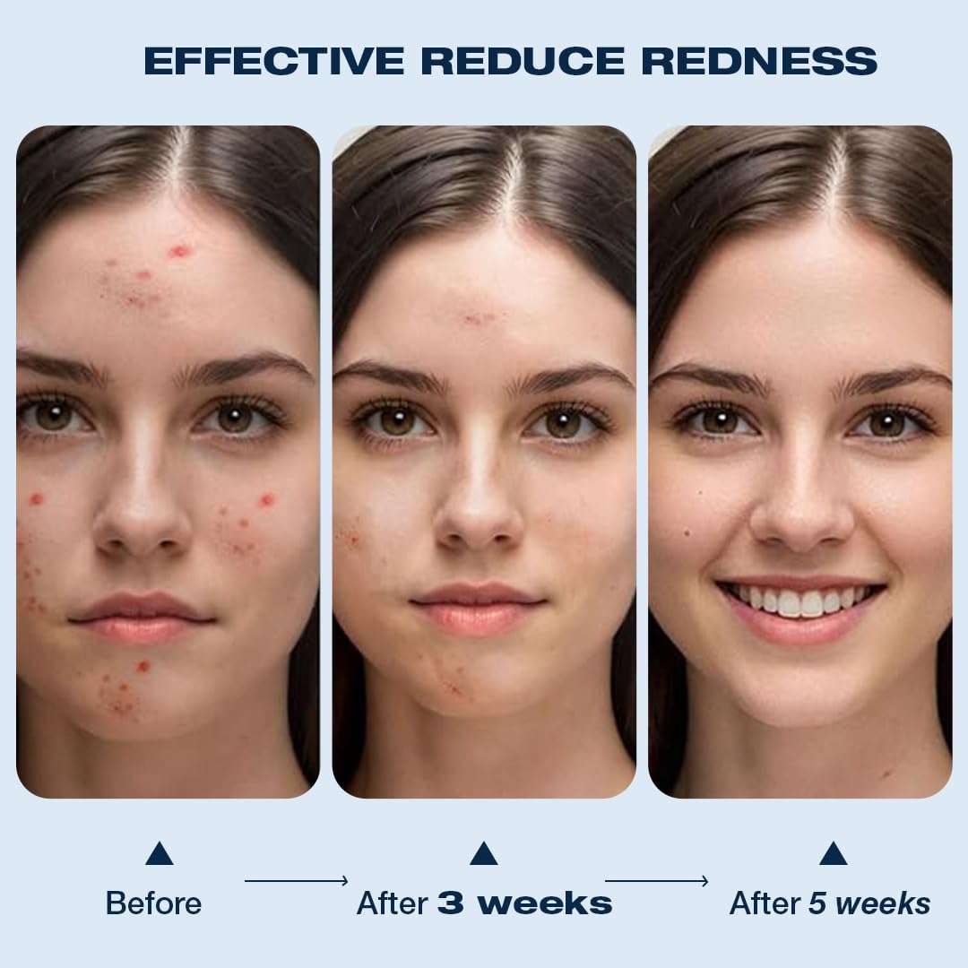 Cheekee Face Towels – Ultra-Soft, Vegan, Dermatologist-Tested. Made for Sensitive Skin & Travel (10 Count) (Pack of 2) 4