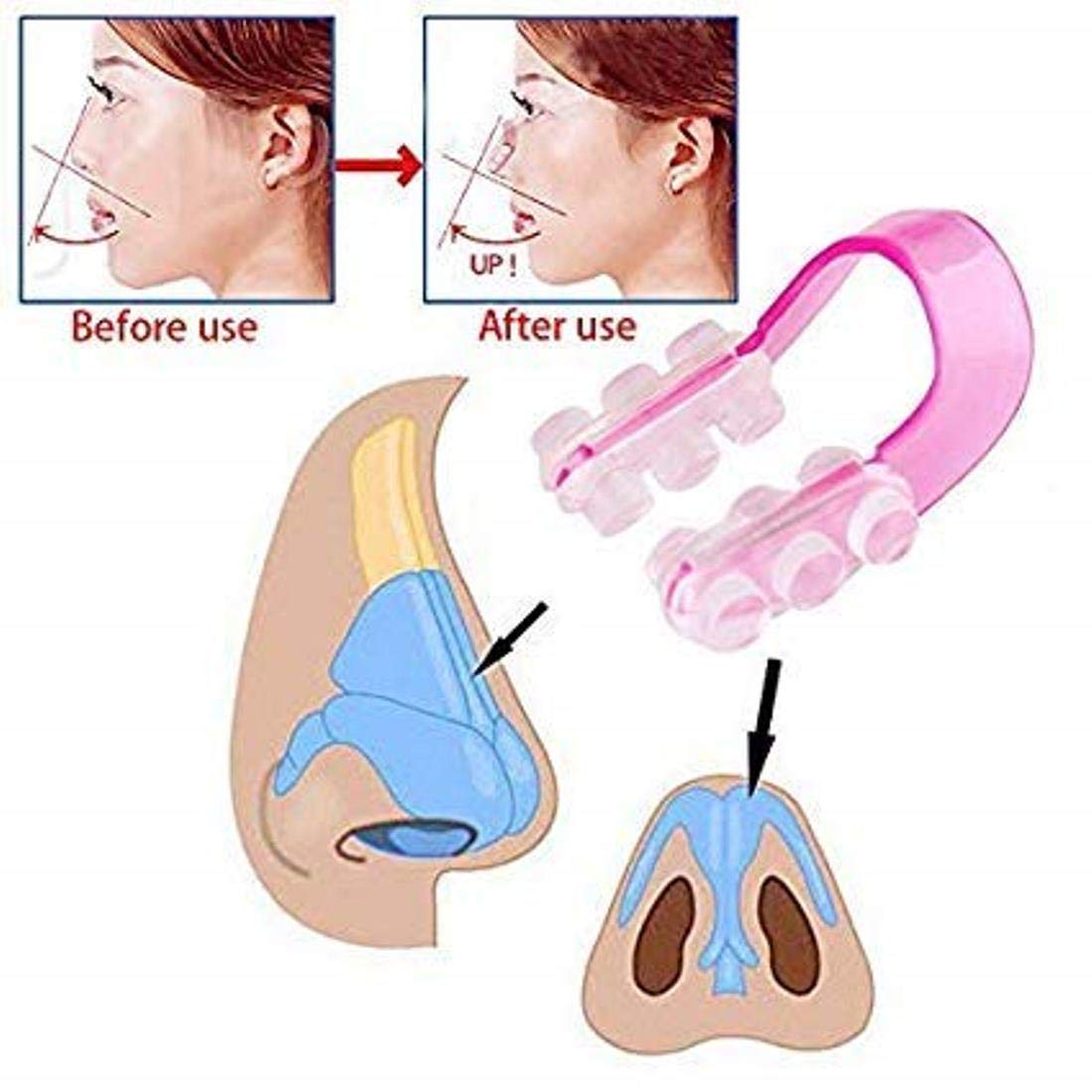Digital Shoppy Secret 3D Invisible Rhino Correct Nose Up Lifting Shaper Clip and Tool Hook Straightening Kit -3 Pieces (Pink, Blue and Black) 3