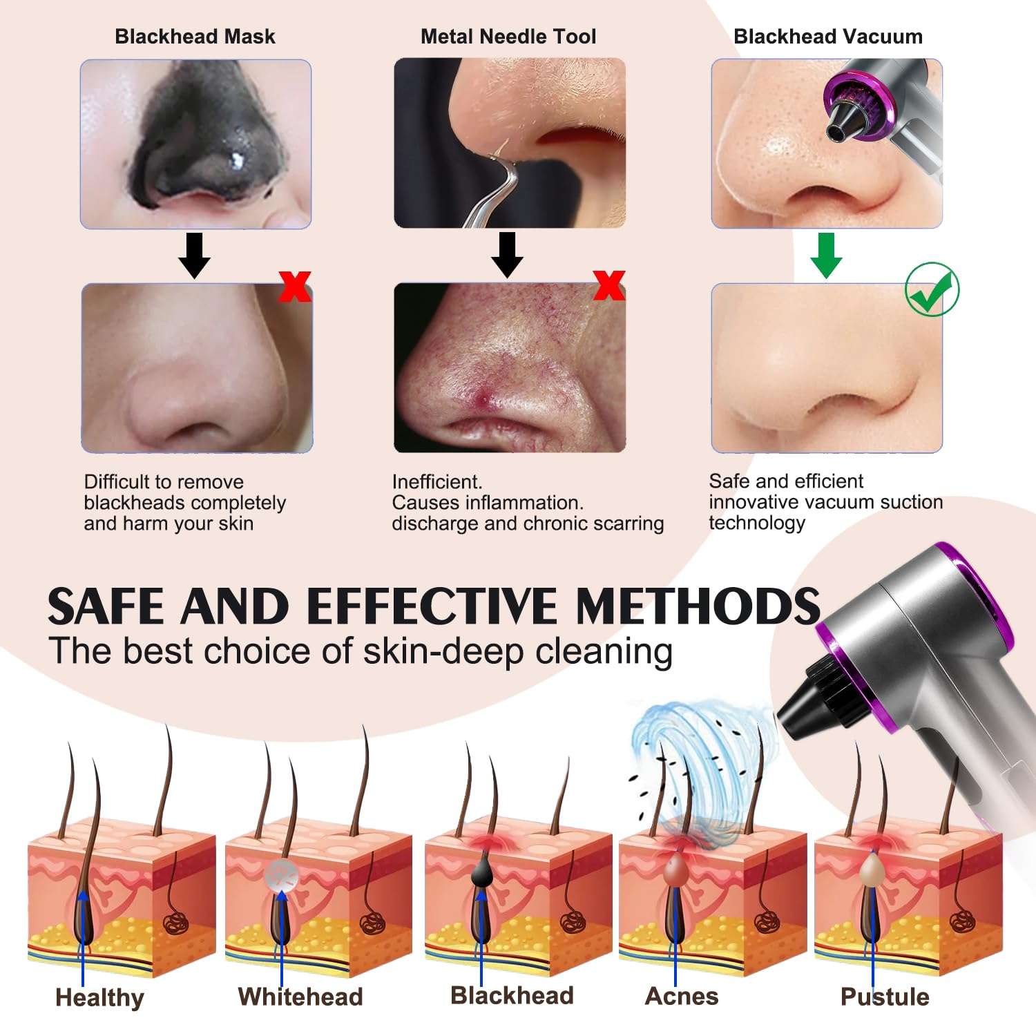 Blackhead Remover Vacuum with Heating, Blackhead Extractor 3 Adjustable Suction Levels 9 Modes, Pore Vacuum Blackhead Suction Remover, Comedone Extractor Kit for Deep Pore Cleaning (Purple) 5