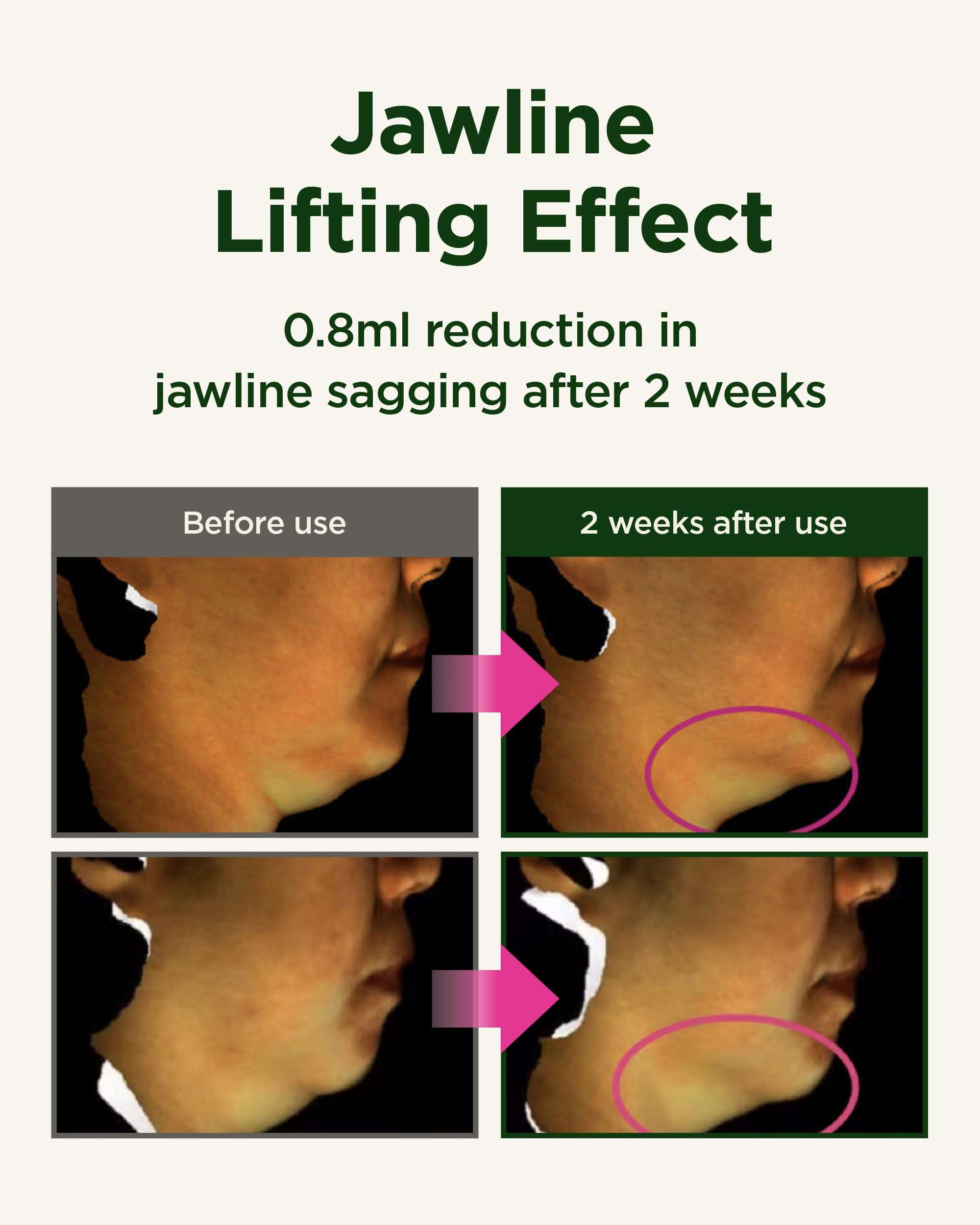 CKD Gua Sha Neck Cream 1.69 fl oz & Retino Collagen Facial Sheet Mask (5ea) Retino Collagen Lifting Cream for Neck Wrinkles Hydrogel Sheet Mask Pore Tightening, Firming, Moisturizing Korean Skin Care. 5