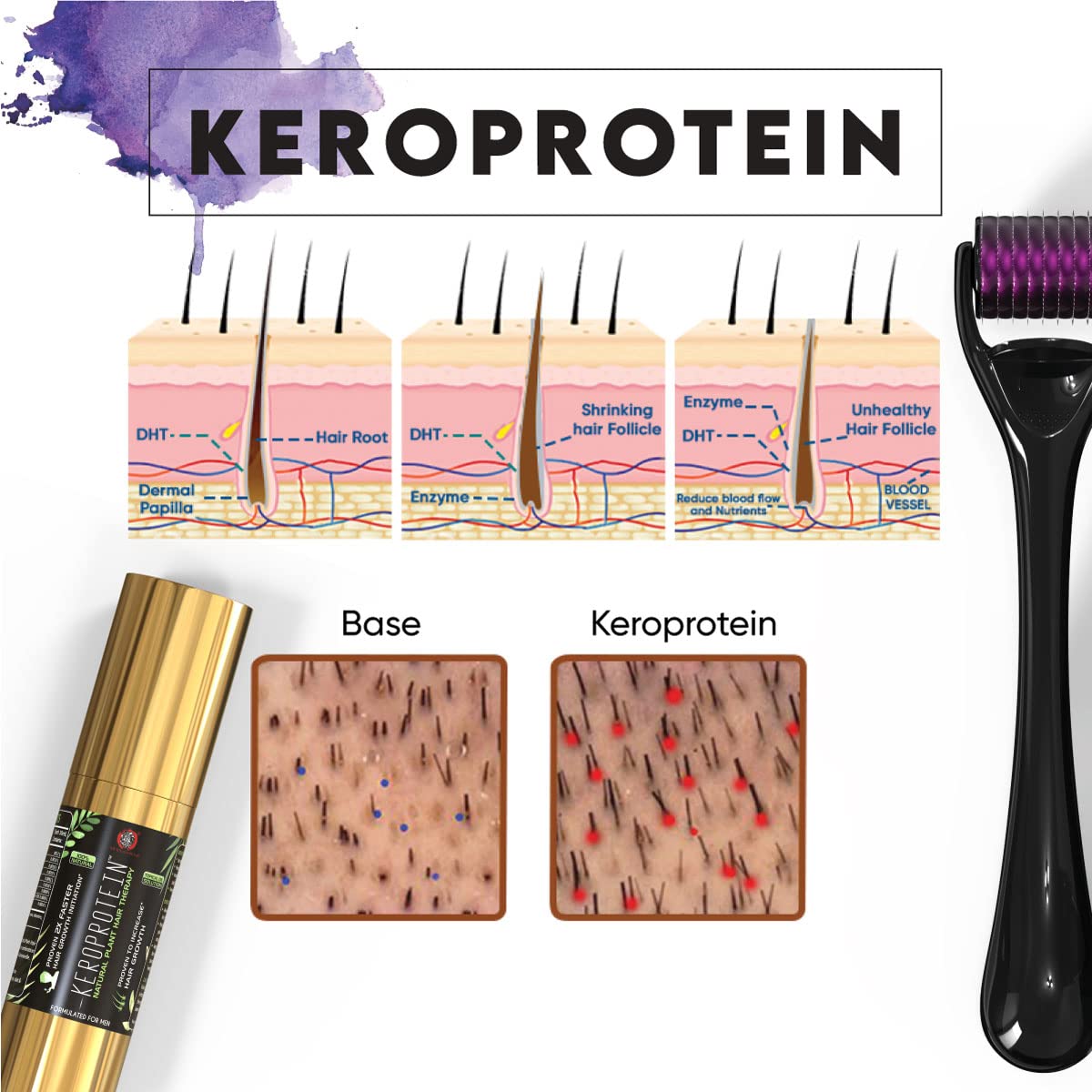 The Yoga Man Lab Keroprotein Hair Growth Kit (Men) Topical Hair Growth Oil (30ml) + DHT Blocker Oral Oil (30ml) + Keroneedle 0.5mm Natural Ayurvedic Plant Oils For Healthy Hair 6