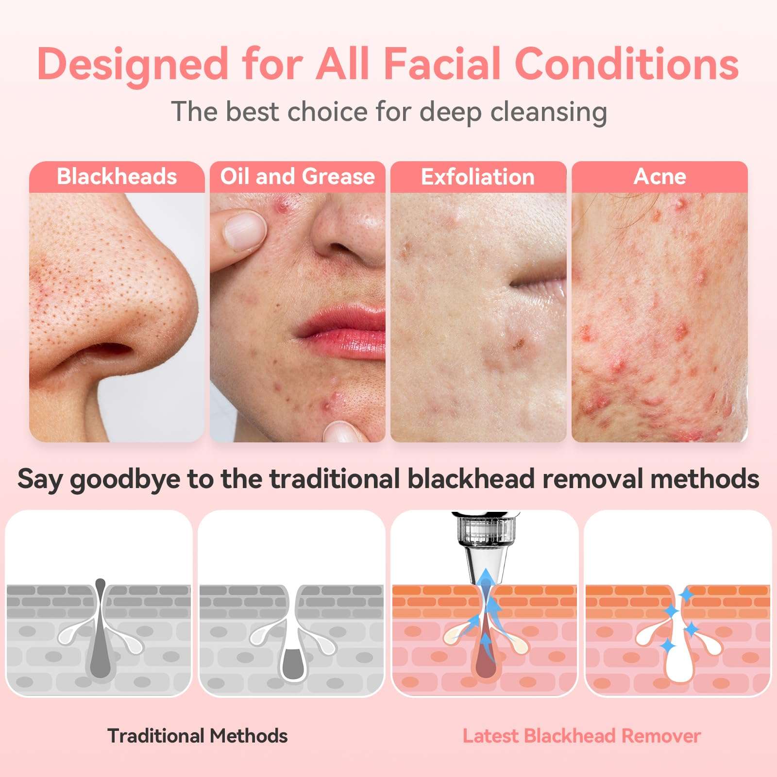 Blackhead Remover Pore Vacuum Upgraded Facial Pore Cleaner Electric Comedone Whitehead Extractor Tool-5 Suction Power,5 Probes,USB Rechargeable Blackhead Vacuum Kit for Women & Men 5