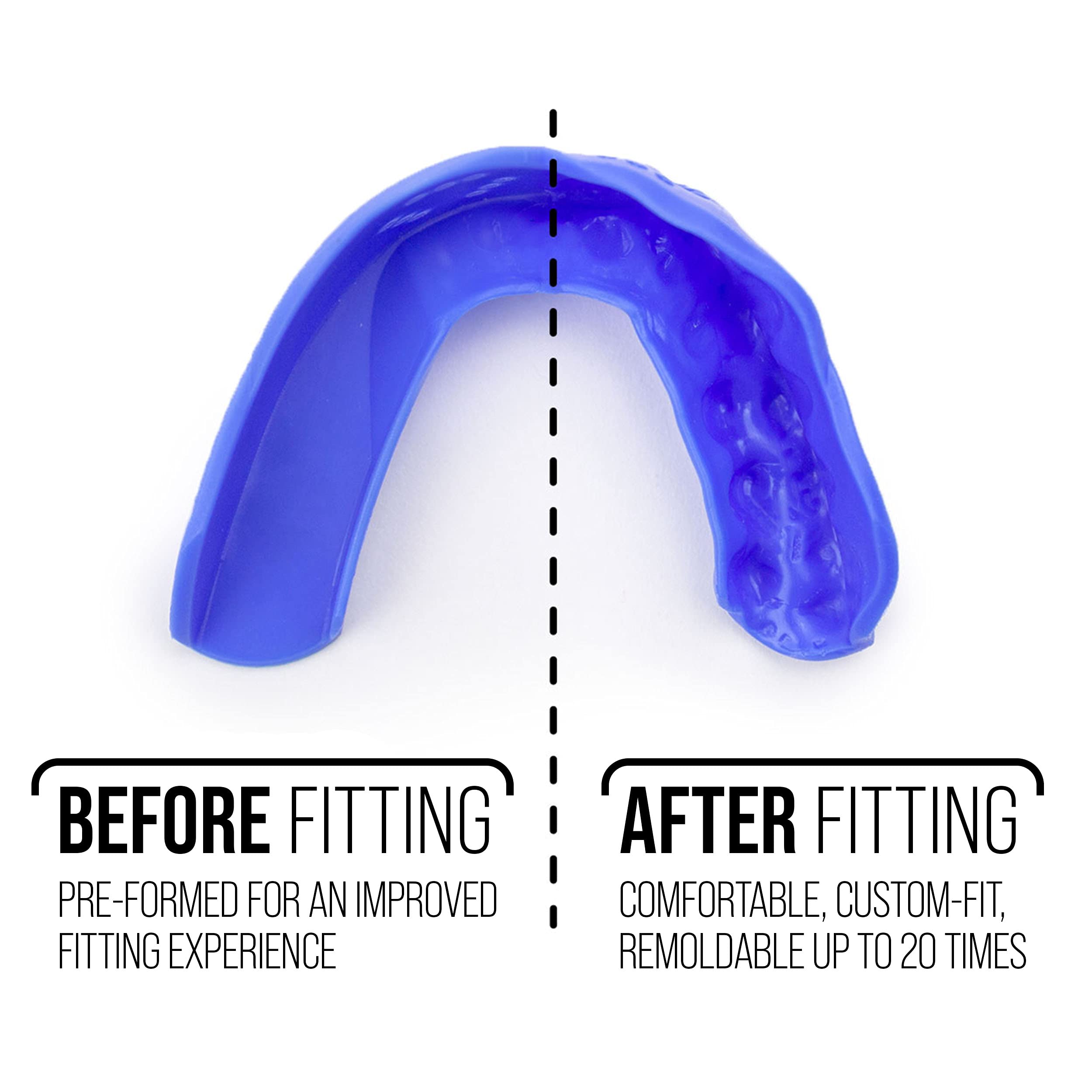 SISU 3D Mouthguard, Charcoal Black with Case - 2.0mm Thin - for Athletes Over 5’ Tall - Pre-Formed for Custom-Molded Fit - Remoldable Up to 20 Times - Non Toxic 6