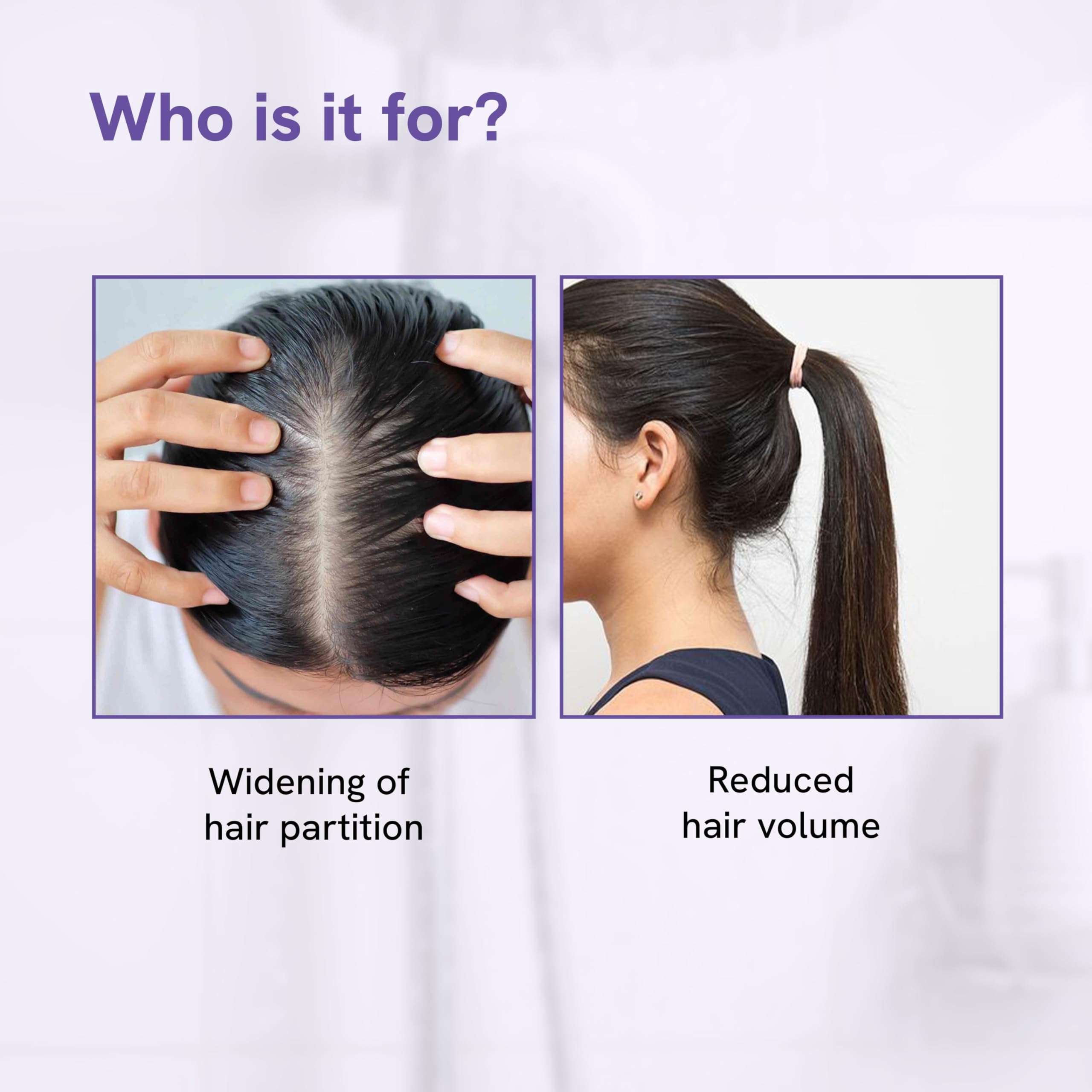 Be Bodywise Hair Growth Serum | 21% Hair Growth Actives | 3% Redensyl, 3% Procapil, 2% Baicapil | For Hair Fall Control | For Men & Women | 50ml 6