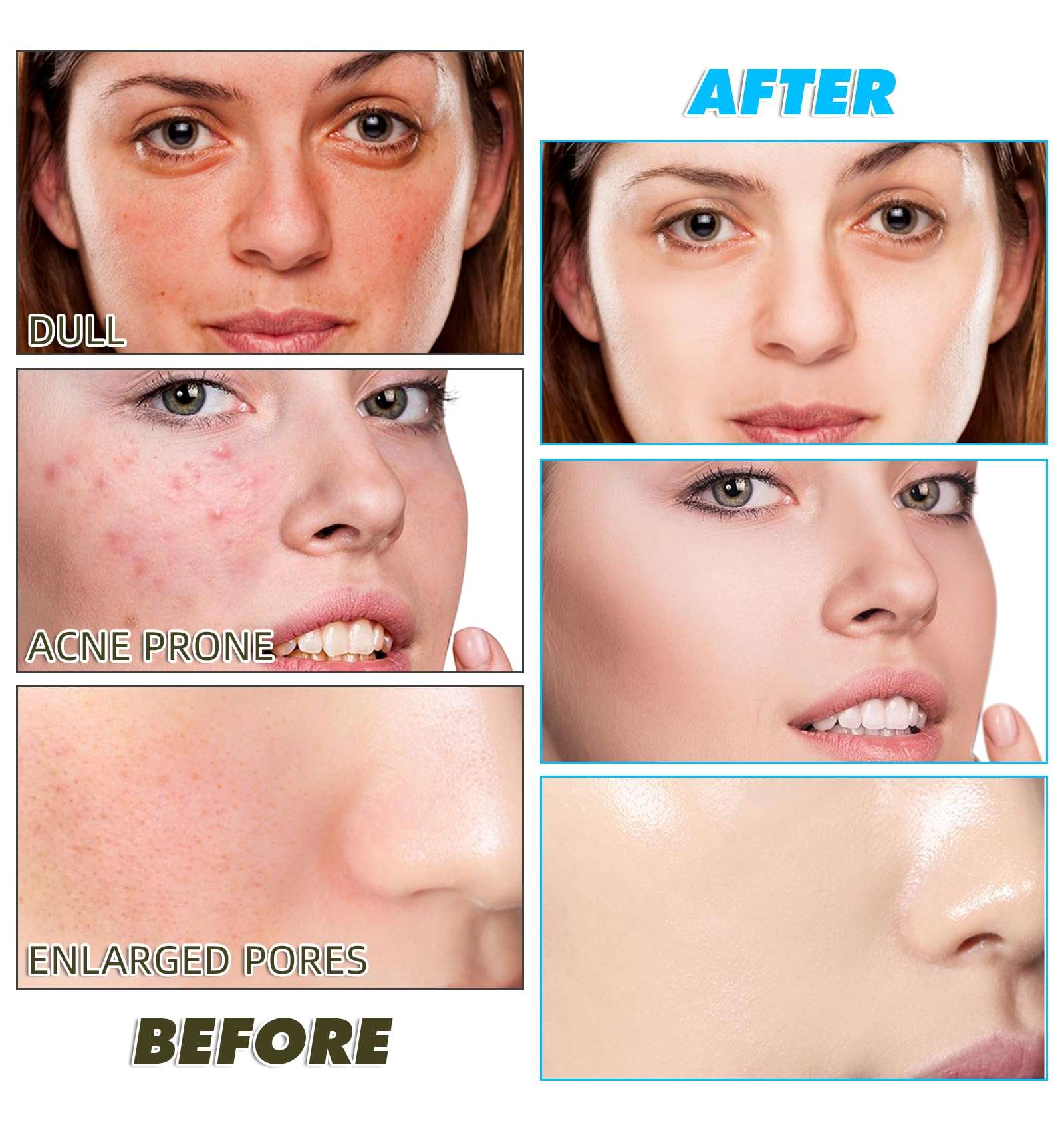 Kojic Acid and Turmeric Cleansing Pads, 60PCS Turmeric Kojic Acid Pads, Turmeric Cleansing Pads for Face Dark Spots, Deep Clean, Foaming Turmeric Exfoliating Pads - Less Mess, Safe For All Skin Type 6