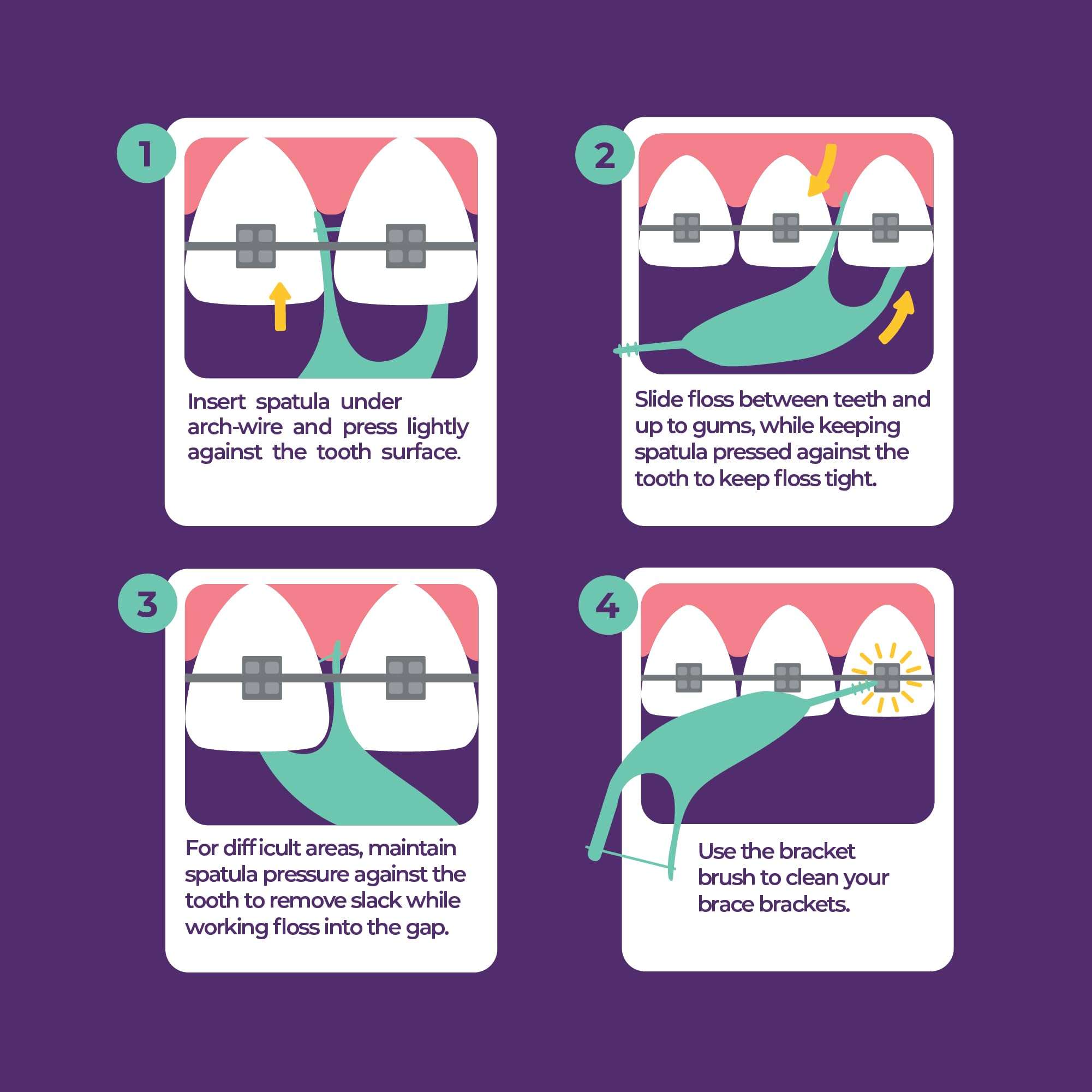 Platypus Orthodontic Flossers for Braces, 30 Count (Pack of 1), Ortho Picks for Adults & Kids, Fits Under Arch Wire, Non-Damaging, Encourage Flossing Habits 3