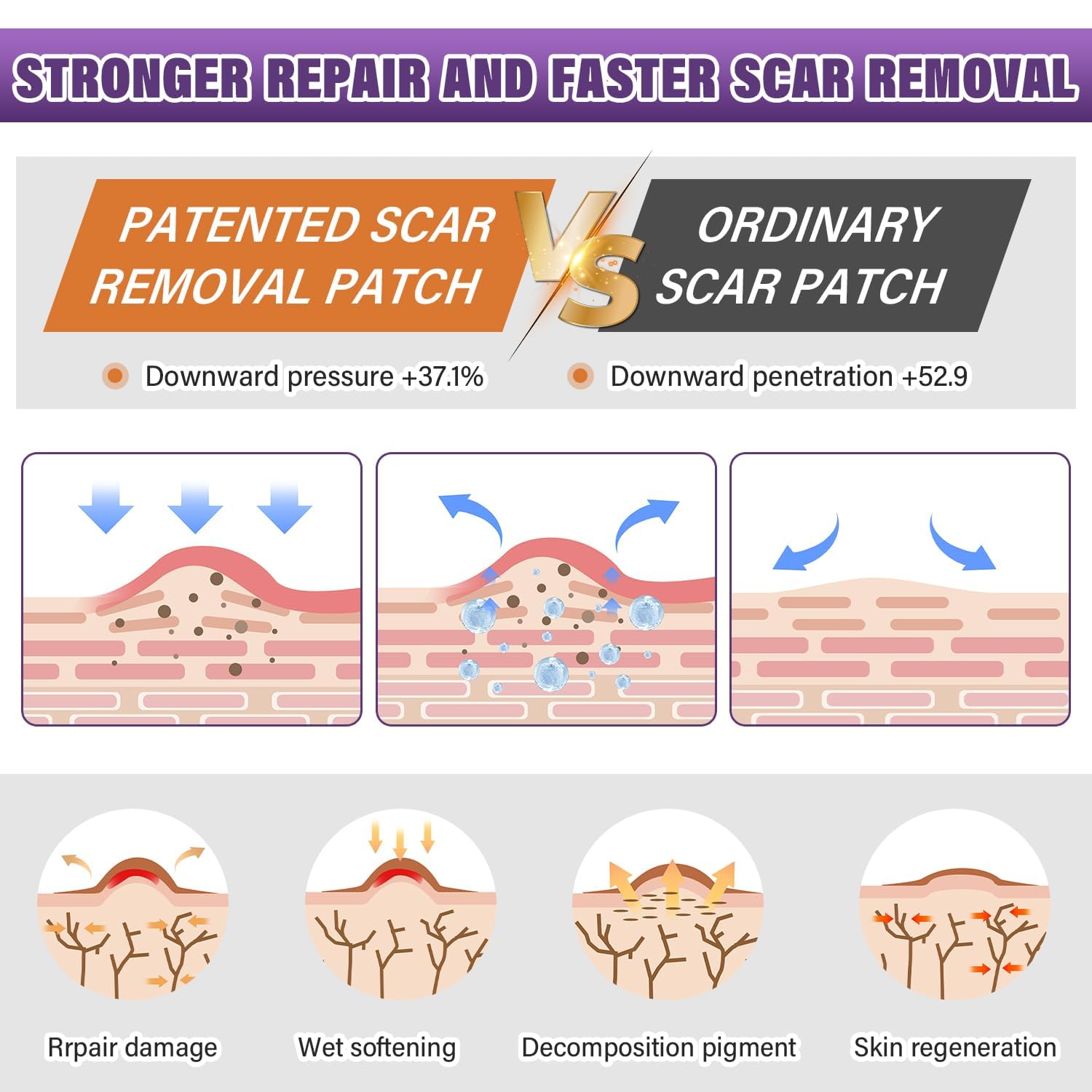 Silicone Scar Sheets,Silicone Scar Tape,Silicone Scar Removal Strips for Surgical,C-Section,Tummy Tuck,Keloid Scars (1.6"X 59" Roll-1.5M) Keloid Bump Removal 3