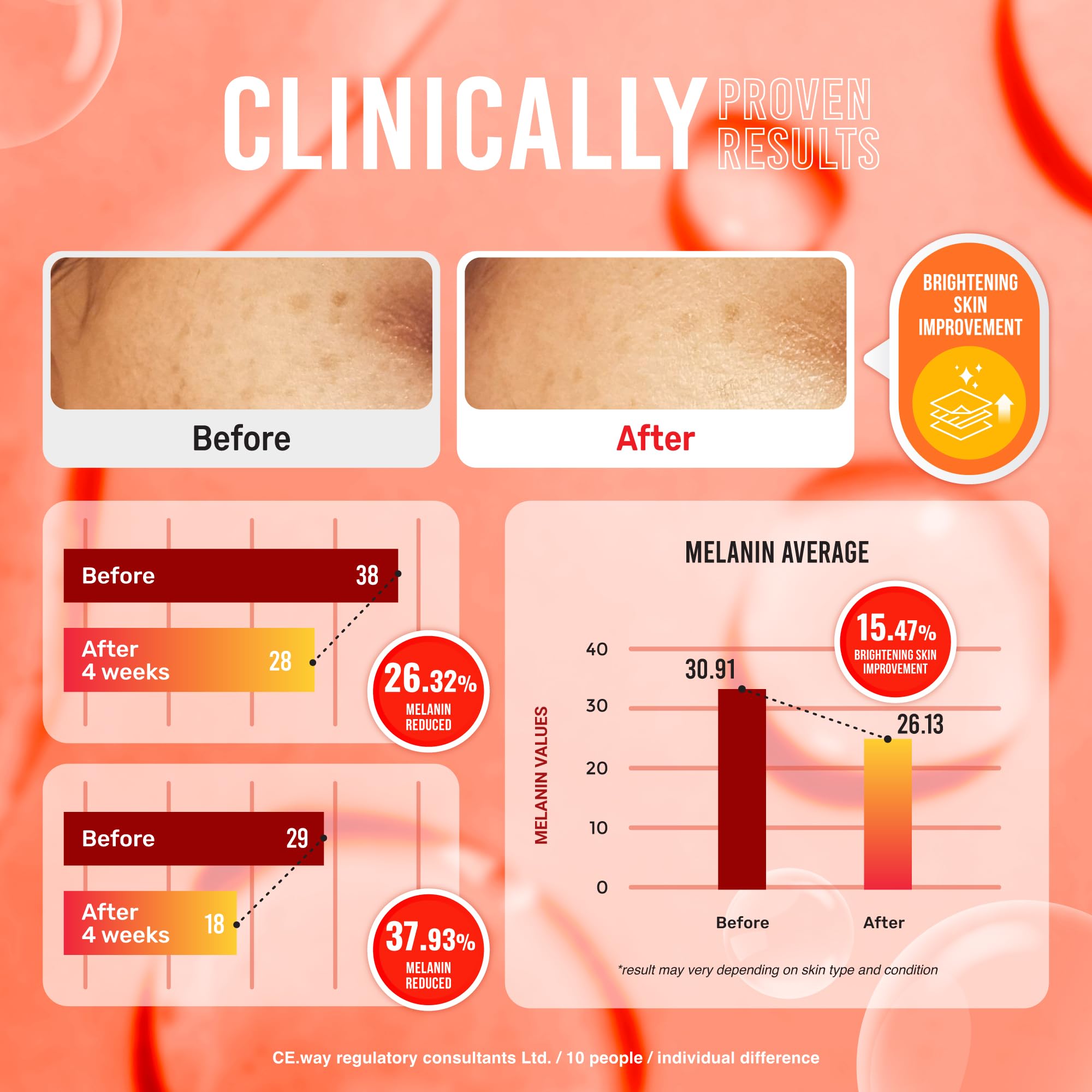 Koji White Pure Kojic Acid Soap | Glycerin Soap Bar for Gentle Skin Brightening and Exfoliation with Tea Tree, Coconut Oil, Hyaluronic Acid & Vitamin C, Vegan, 2.82 oz 2