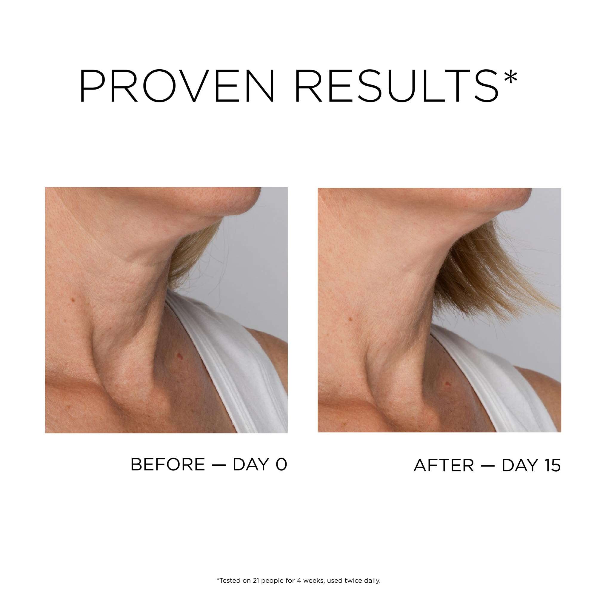 IDC Dermo Profil Décolleté Cream for Neck And Décolleté - 2.7 fl oz - Vegan Anti Aging Neck And Decollete Firming And Lifting Cream for Women - Breast Lift Peptide Complex Cream for Tightening 5