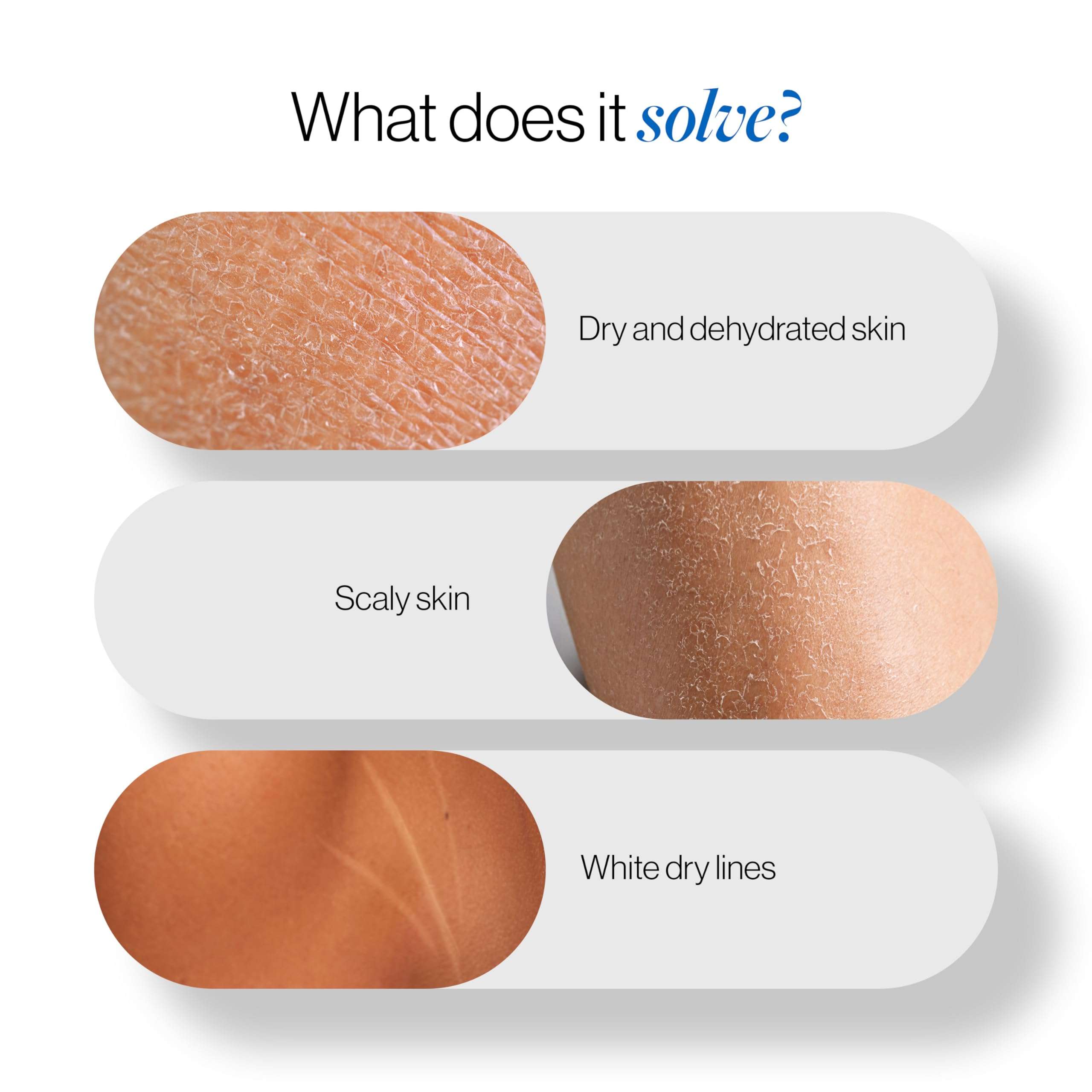 Be Bodywise Triple Milk Deep Moisturizing Body Wash 250ml |For Dry & Dehydrated Skin | With 6% Triple Milk Extracts & 3% Hydrating Boosters | Lasting Hydration & Skin Barrier Support | Paraben & SLS Free 4