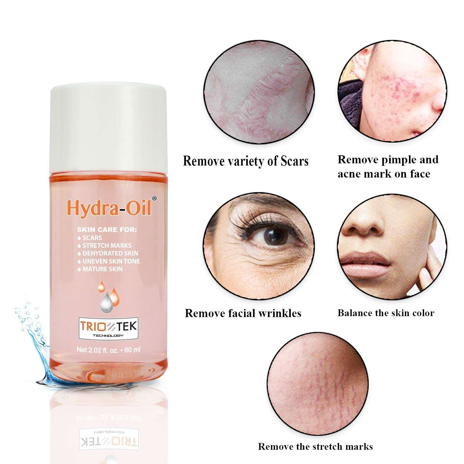 Hydra-Oil Scar Removal Serum - Scar Treatment for Face and Body - 50 ml Hydrating Oil for Acne Scar Remover, Stretch Mark Removal, and to Lighten Dark Spots - Vitamin E & A 3