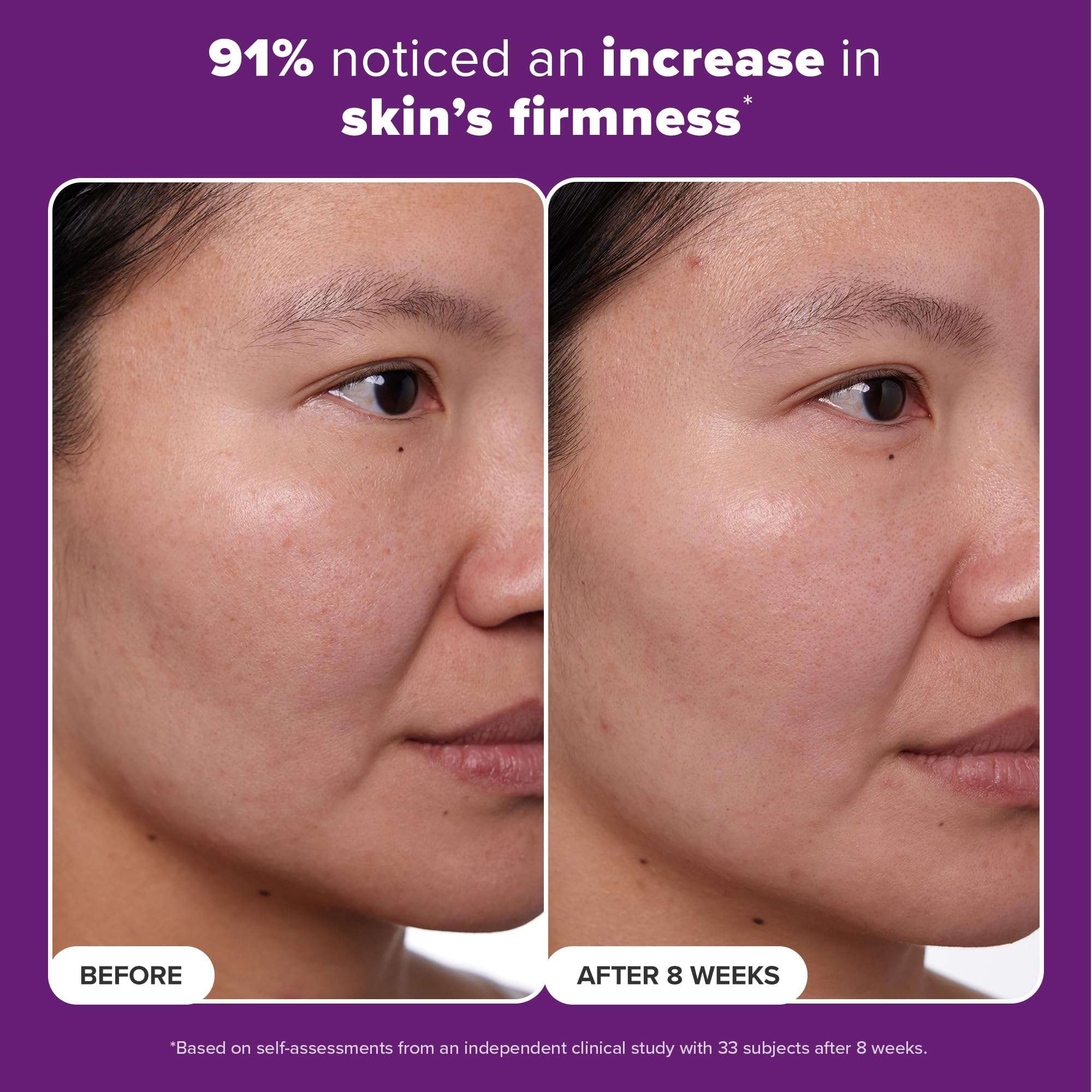 Paula's Choice CLINICAL 1% Retinol Face Moisturizer Treatment with Peptides, Vitamin C & Licorice Extract, Firming Face Cream, Anti-Aging & Wrinkles, Fragrance Free, 1 Fl Oz 4