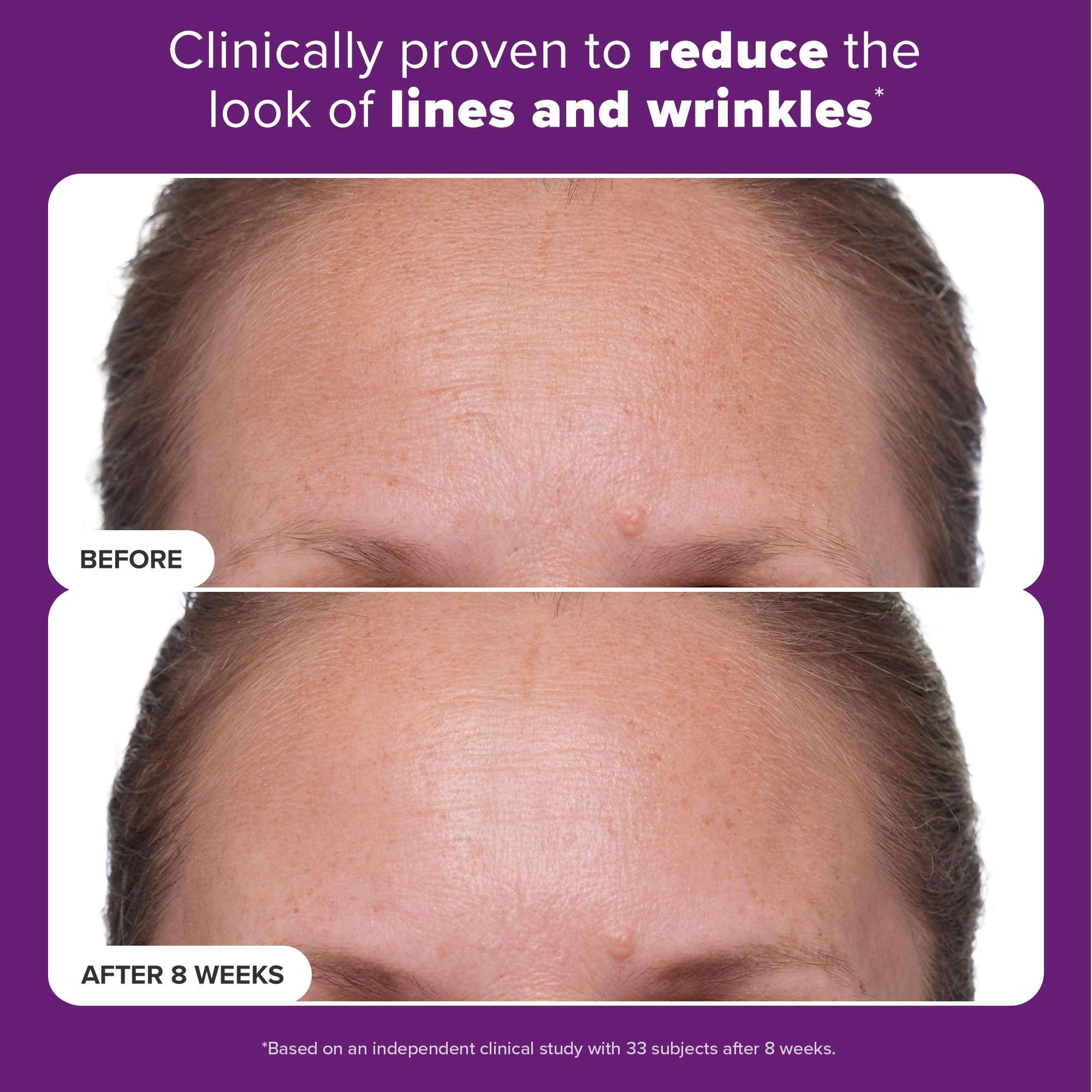 Paula's Choice CLINICAL 1% Retinol Face Moisturizer Treatment with Peptides, Vitamin C & Licorice Extract, Firming Face Cream, Anti-Aging & Wrinkles, Fragrance Free, 1 Fl Oz 3