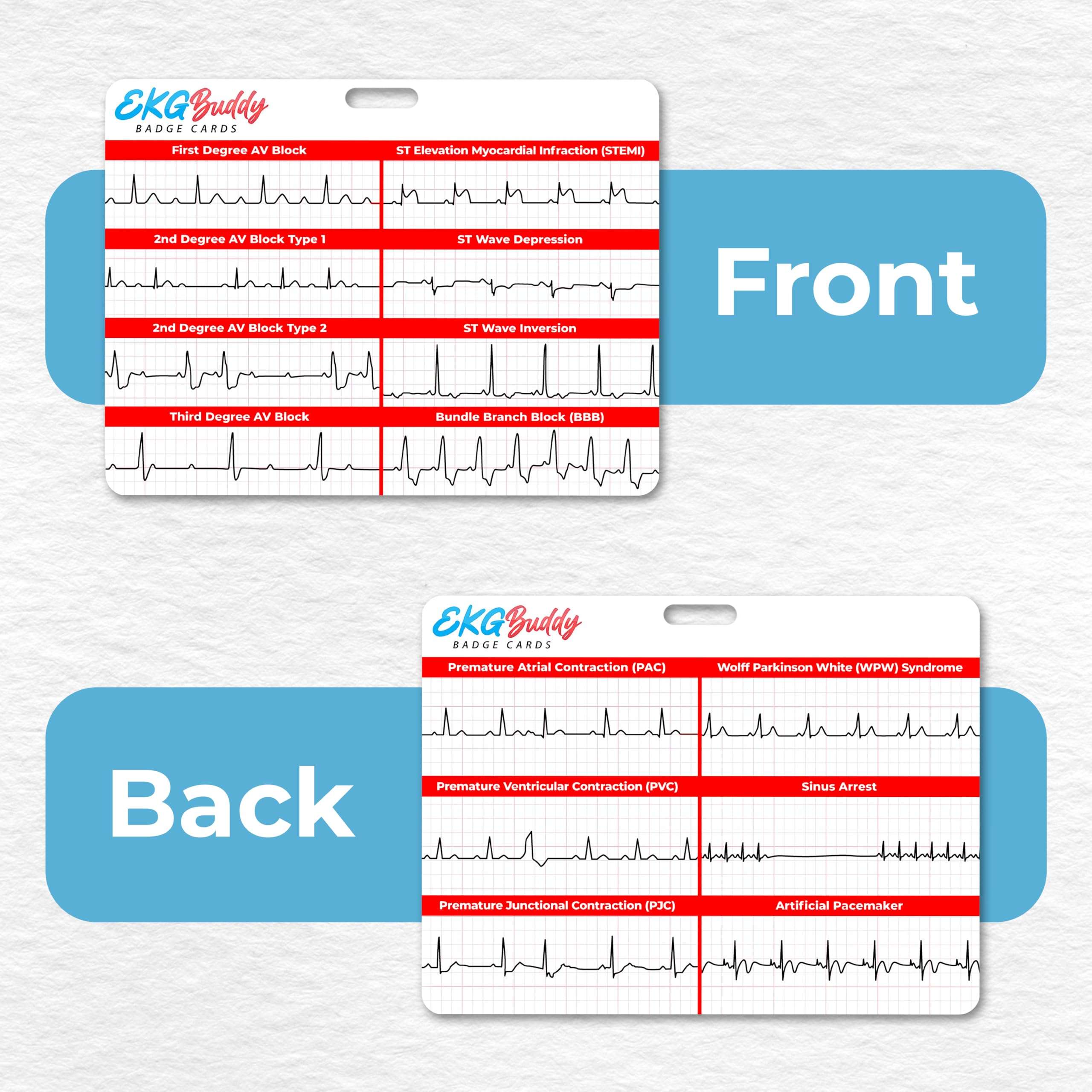 EKG Buddy's 5 Card EKG Interpretation Badge Set - Doubled Sided Nurse ECG Cards Guide Rhythm Cheat Sheet, EKG Telemetry Strips for ACLS Medical Cardiac Reference and Nursing Student Gift Accessories 4