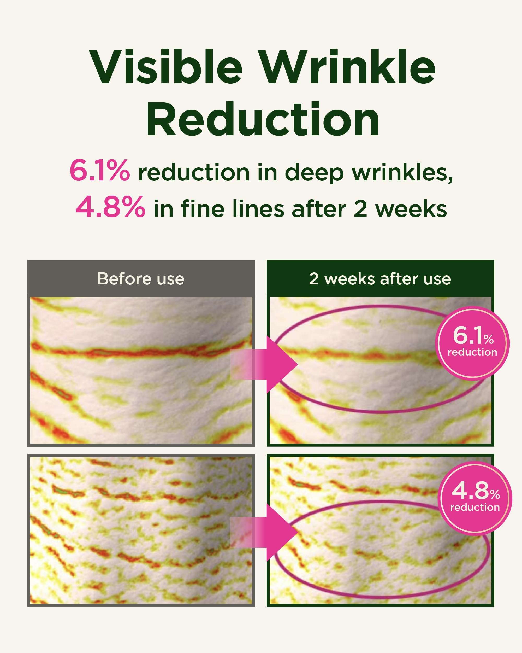 CKD Gua Sha Neck Cream 1.69 fl oz & Retino Collagen Facial Sheet Mask (5ea) Retino Collagen Lifting Cream for Neck Wrinkles Hydrogel Sheet Mask Pore Tightening, Firming, Moisturizing Korean Skin Care. 4