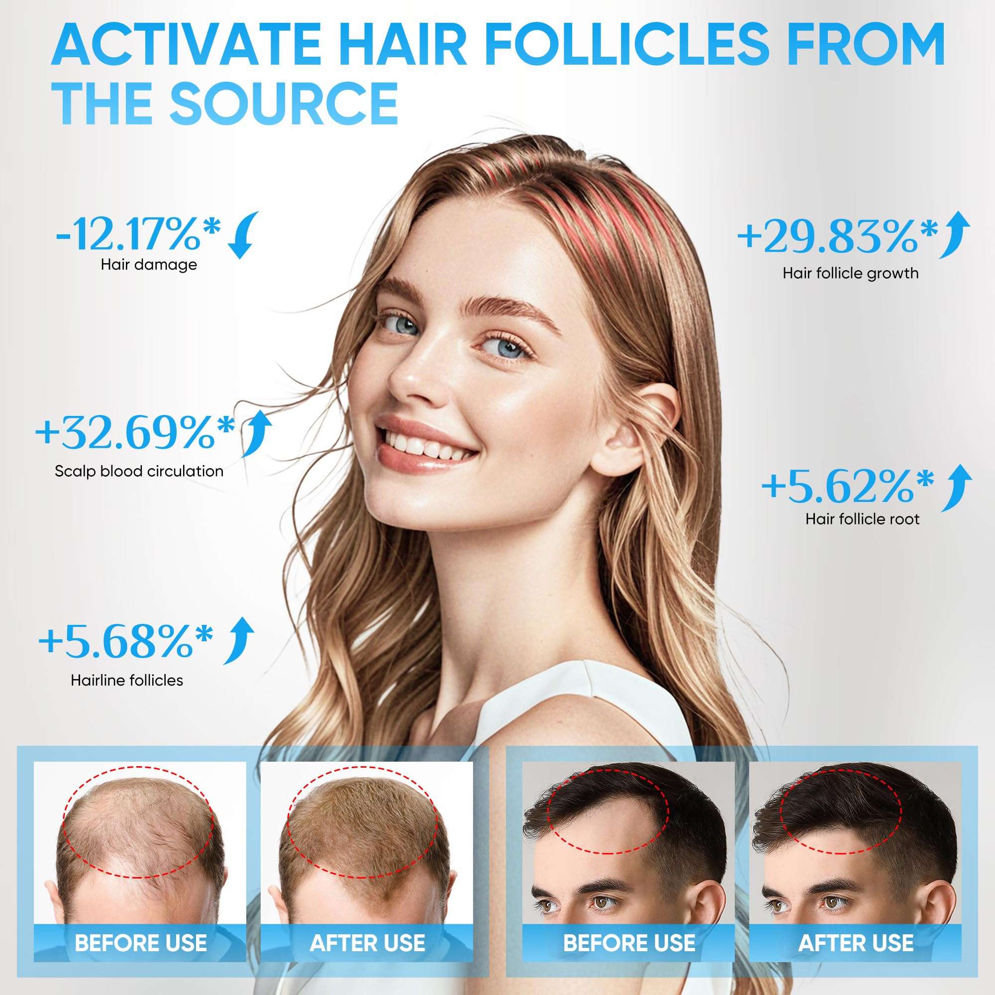 Hair Growth Device, 678nm Red Light Therapy System, Suitable for Thinning Hair, Hair Loss Treatment, Scalp Health Restoration, etc. for Men and Women. Wireless, Hands-free Hair Growth Helmet 5