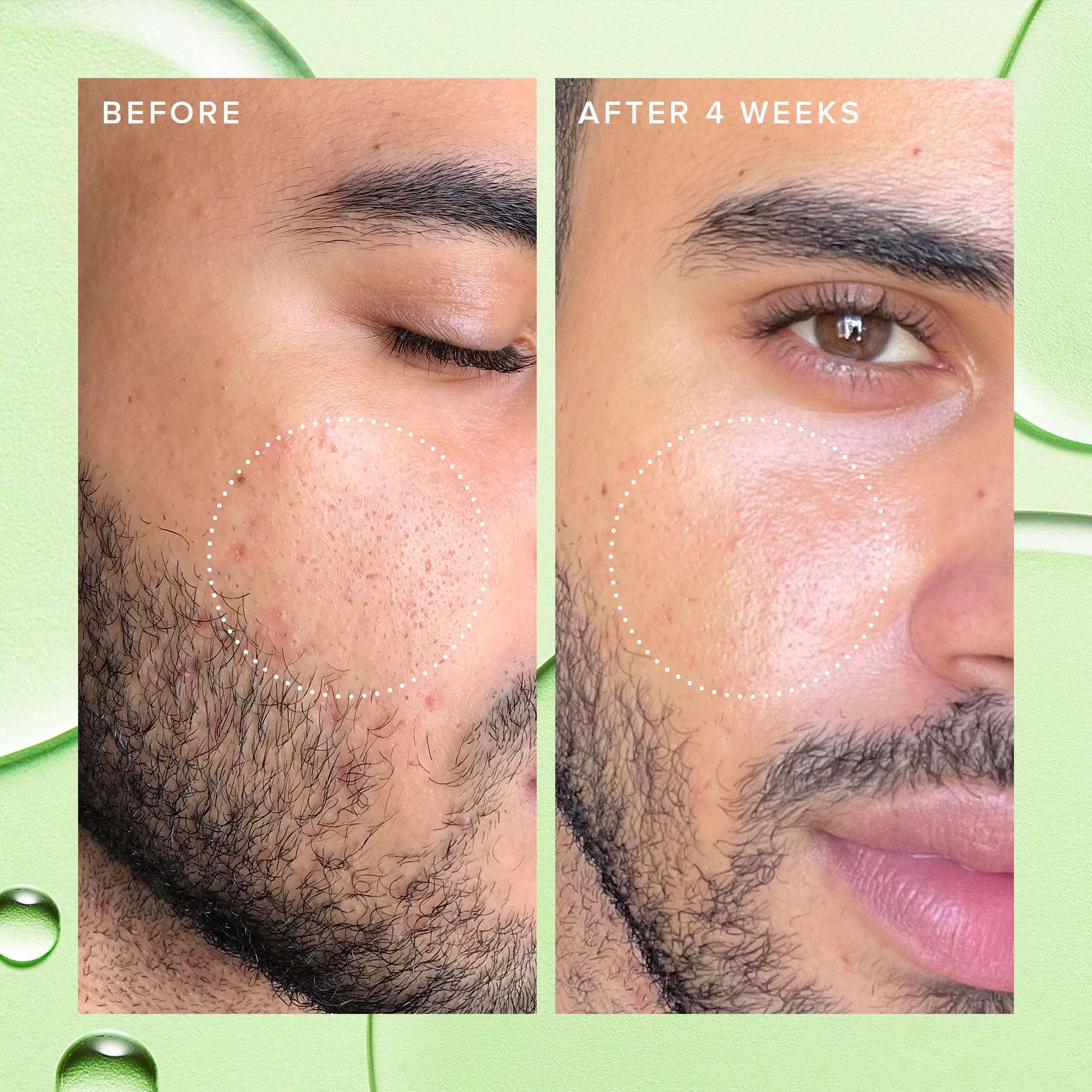 Farmacy 2% Salicylic Acid Toner for Face - Deep Sweep Gentle BHA Exfoliant for Oily Skin - Refines Texture with Papaya Enzymes & Moringa Water for a Healthy-Looking Complexion (10ml) 5