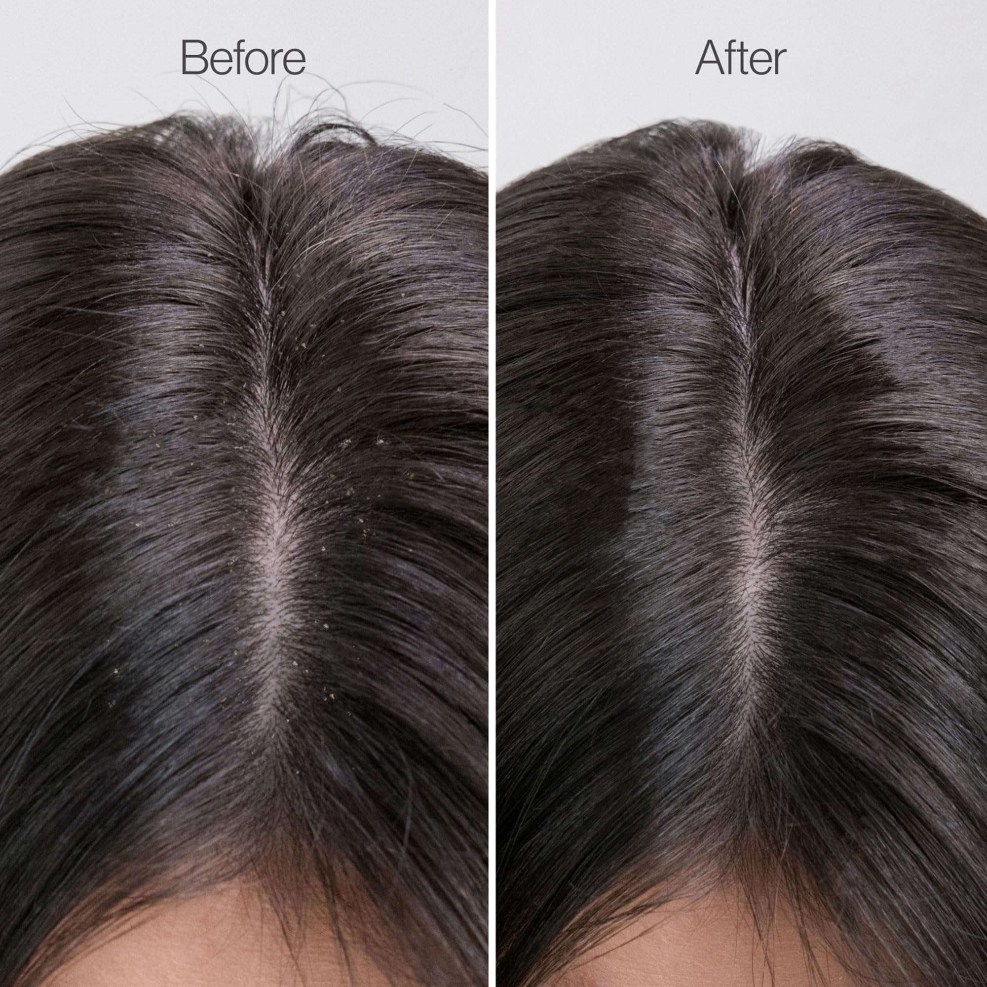 Freewill Clarifying Detox Conditioner - Scalp Cleansing Conditioner for Oily Hair, Build Up Remover, Balances Hair Hydration without Stripping, 8.5 oz 4