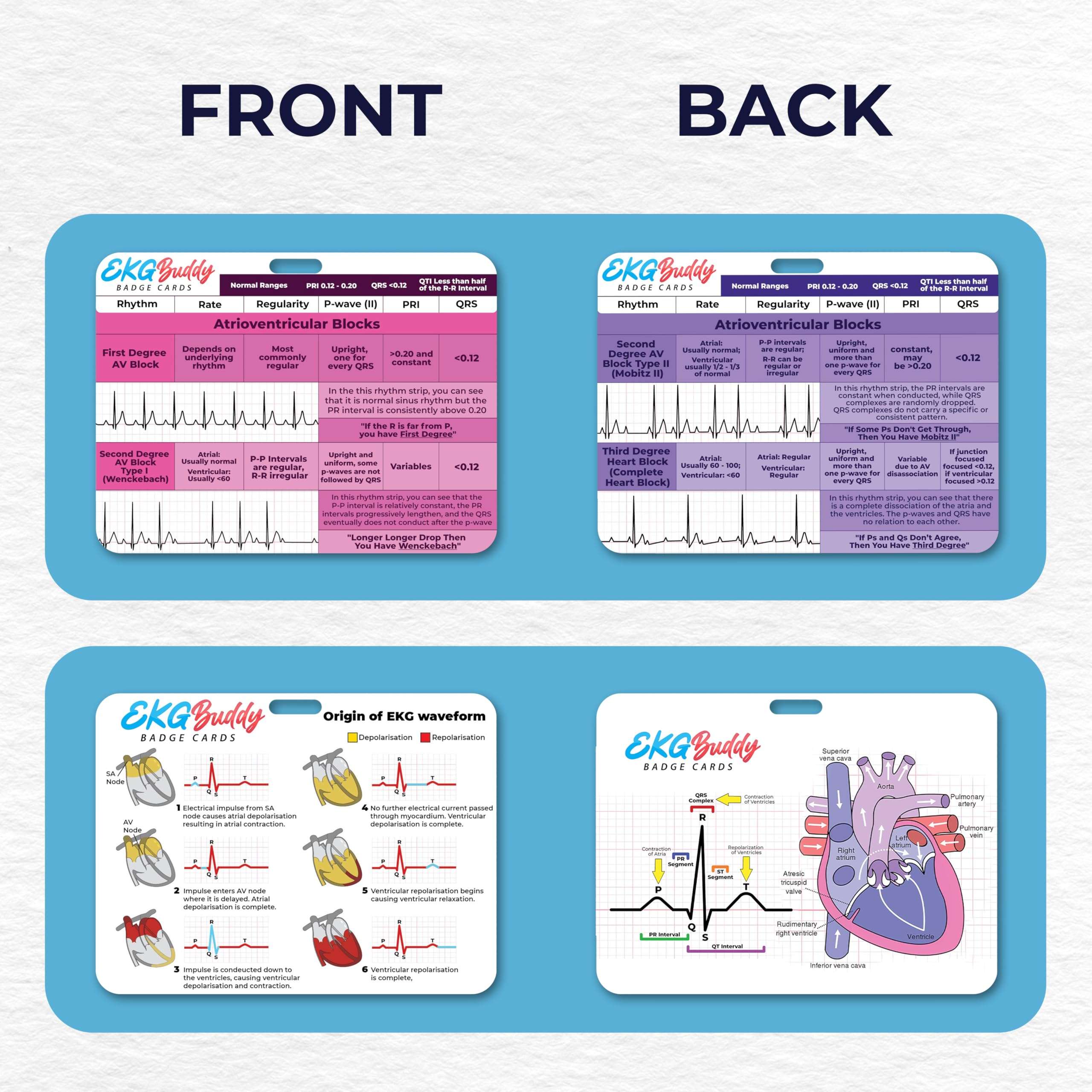 EKG Buddy's 5 Card EKG Interpretation Badge Set - Doubled Sided Nurse ECG Cards Guide Rhythm Cheat Sheet, EKG Telemetry Strips for ACLS Medical Cardiac Reference and Nursing Student Gift Accessories 3