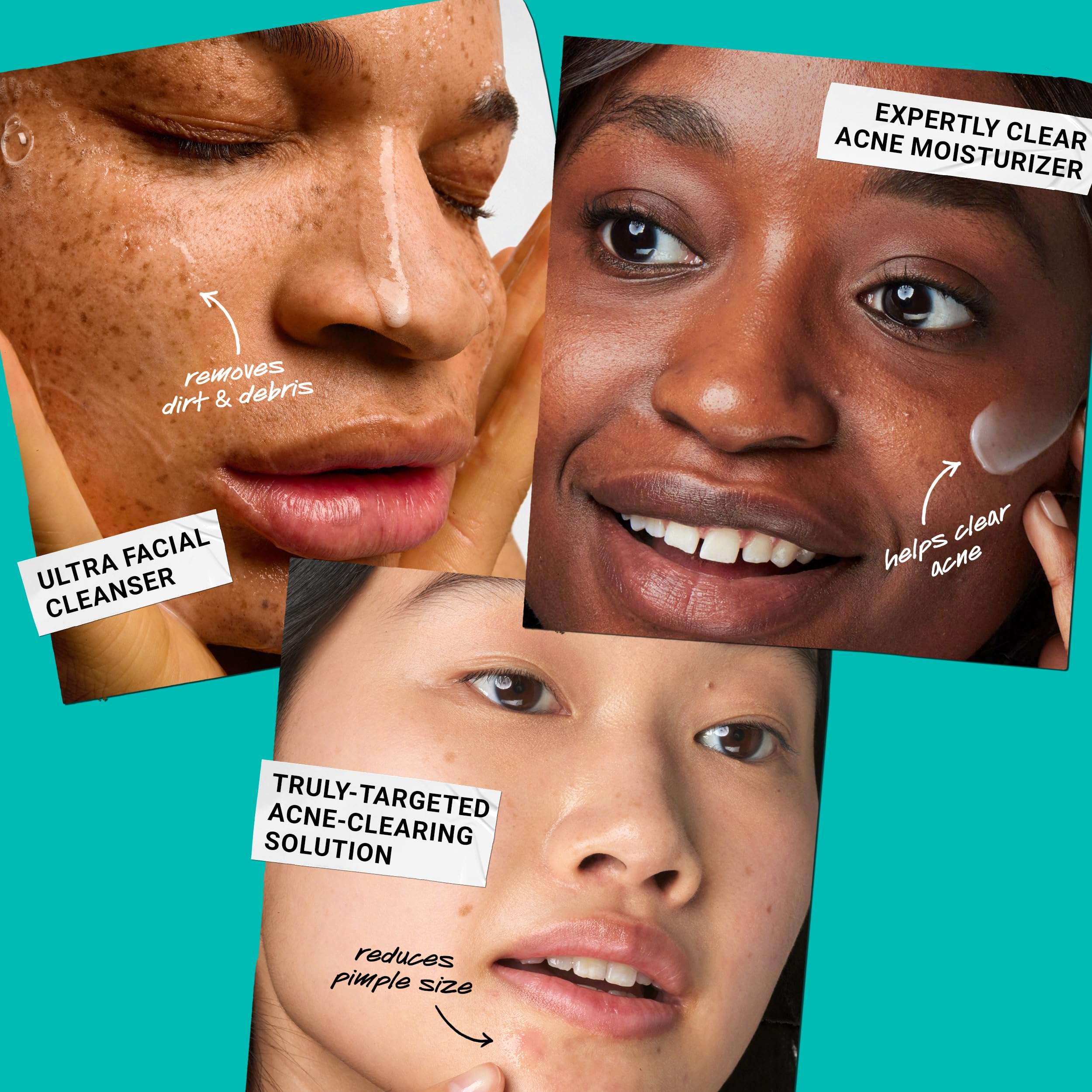 Kiehl's Acne Routine Skincare Set - $87 Value Including Cleanser, Acne Spot Treatment, and Salicylic Acid Gel Moisturizer - Prevent Breakouts 6